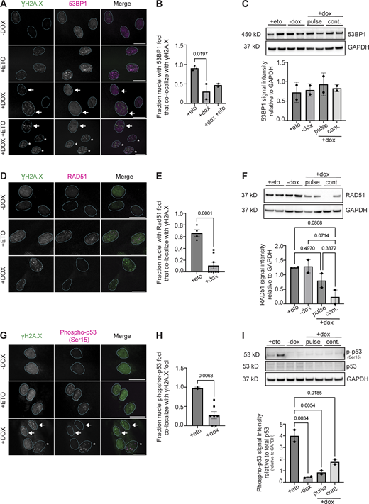 DDR factors have impaired recruitment to sites of DNA damage in DUX4-expressing cells. (A) Representative immunofluorescence images of γH2A.X signal (green) and 53BP1 signal (magenta) in uninduced (−dox), treated with 10 μM etoposide for 30 min and immediately fixed (+eto), briefly induced with 2 μg/ml doxycycline for 4 h and fixed 20 h after induction (+dox), or briefly induced with 2 μg/ml doxycycline for 4 h and at 20 h after induction treated with 10 μM etoposide for 30 min and then immediately fixed (+dox +eto), (scale bar = 20 μm). White arrows indicate nuclei with γH2A.X foci that lack 53BP1 foci. The asterisk indicates nuclei with γH2A.X foci that have 53BP1 foci colocalization. Images are representative of four independent experiments conducted on separate days. (B) Quantification of fraction nuclei with 53BP1 signal overlap with γH2A.X signal are indicated for two independent experiments and N ≥ 100 nuclei per condition within each experiment. (C) Quantification of total 53BP1 protein levels in +eto, −dox, pulse, or continuous +dox conditions. N = 3 per condition; blot shows two biological replicates for each condition. (D) Representative immunofluorescence images of γH2A.X signal (green) and RAD51 signal (magenta) in −dox, +eto, or +dox iDUX4 cells, (scale bar = 20 μm). The cell cycle state for each imaged nucleus was not determined. Images are representative of three independent experiments conducted on separate days. N ≥ 100 nuclei imaged. (E) Quantification of fraction RAD51 signal overlap with γH2A.X signal in nuclei are indicated for two independent experiments and N ≥ 100 nuclei per condition within each experiment. (F) Quantification of total RAD51 protein levels in +eto, −dox, pulse, or continuous +dox conditions. Three biological replicates were used; blot shows two biological replicates for each condition. Note that Fig. S3 F uses the same GAPDH control image because the same western membrane was used to probe for RAD51 and RNF168. (G) Representative immunofluorescence images of γH2A.X signal (green) and phosphor-p53 (Ser15) signal (magenta) in −dox, +eto, or +dox iDUX4 cells, (scale bar = 20 μm). White arrows indicate nuclei with γH2A.X foci that lack phosphor-p53 foci. Asterisk indicates nuclei with γH2A.X foci that have phosphor-p53 foci colocalization. Images are representative of two independent experiments conducted on separate days. N ≥ 50 nuclei imaged. (H) Quantification of the fraction of nuclei containing phosphor-p53 that colocalize with γH2A.X foci. Fraction calculated per field of images taken from each independent experiment and N ≥ 50 nuclei. (I) Quantification of total phosphor-p53 protein levels in +eto, −dox, pulse, or continuous +dox conditions. Relative levels are normalized to total p53 levels and then to loading control (GAPDH). N = 3; Blot shows two biological replicates for each condition. (B, C, E, F, H, and I). Data represent means ± SD. Statistical differences between groups were analyzed employing one-way ANOVA Tukey’s multiple comparison test between each group and a control. Source data are available for this figure: SourceData F6.
