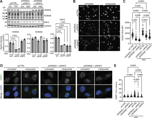 KDM2A/B–RNF2 axis is necessary for H2AUb signaling and DNA damage response. (A) Quantification of total KDM2A, KDM2B, and RNF2 protein levels in control knockdown (siCTRL), in KDM2A and RNF2-depleted cells (siKDM2A + siRNF2) or in KDM2B and RNF2-depleted cells (siKDM2B + siRNF2) with or without etoposide treatment. Blot shows two biological replicates. Protein levels were normalized to loading control (GAPDH). (B) Representative immunofluorescence images of H2AUb signal (gray) within siCTRL cells, siKDM2A + siRNF2 cells, or siKDM2B + siRNF2 cells either left untreated or treated briefly with 10 μM etoposide. Scale bar = 20 μm. Images are representative of three independent experiments conducted on separate days. N ≥ 100 nuclei imaged. (C) Quantification of nuclear H2AUb signal intensity in siCTRL cells, siKDM2A + siRNF2 cells, or siKDM2B + siRNF2 cells with or without etoposide treatment. Dots represent the number of nuclei measured. Nuclei are indicated for representative experiment and N ≥ 100 nuclei per condition. (D) Representative immunofluorescence images of 53BP1 (green) within siCTRL cells, siKDM2A + siRNF2 cells, or siKDM2B + siRNF2 cells either left untreated or treated briefly with 10 μM etoposide. Scale bar = 20 μm. Images are representative of two independent experiments conducted on separate days. N ≥ 100 nuclei imaged. (E) Quantification of the number of 53BP1 foci per nucleus in siCTRL cells, siKDM2A + siRNF2 cells, or siKDM2B + siRNF2 cells with or without etoposide treatment. Nuclei are indicated for representative experiment and N ≥ 50 nuclei per condition. (A, C, and E) Data represent means ± SD. Statistical differences between groups were analyzed employing one-way ANOVA Tukey’s multiple comparison test between each group and a control. Source data are available for this figure: SourceData F8. Refer to the image caption for details.