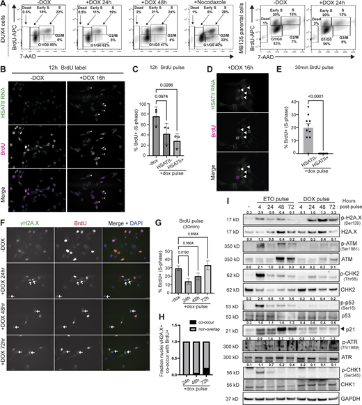 DUX4 expression induces DNA damage but fail to activate DNA damage response pathways. (A) Cell cycle flow cytometry analysis in −dox cells (iDUX4 or MB135 parentals), cells briefly induced with 2 μg/ml doxycycline for 4-h (+dox) and fixed at 24 h (iDUX4 or MB135 parentals) or 48 h (iDUX4 only), or cells treated with 0.5 μg/ml nocodazole for 24-h (control, iDUX4 only). The cell cycle was determined by BrdU-APC and 7-AAD staining. G1 accumulation in −dox cells at 24 h compared with +dox cells at 24 or 48 h after induction. N = 3. (B) Representative immunofluorescence of HSATII RNA (green) and BrdU (magenta) in induced cells 12 h after a 4-h pulse of doxycycline and 12-h pulse of BrdU leading up to fixation. Arrows indicate HSATII+ nuclei. Scale bar = 20 μm. Images are representative from three independent experiments conducted on separate days. N ≥ 100 nuclei imaged. (C) Fraction of nuclei that contain BrdU staining in either uninduced and induced cells either with no HSATII RNA (HSATII−) or with HSATII RNA (HSATII+). Dots represent independent experiments. N ≥ 100 nuclei. (D) Representative immunofluorescence of HSATII RNA (green) and BrdU (magenta) in induced cells 12 h after a 4-h pulse of doxycycline and 30-min pulse of BrdU prior to fixation. Arrows indicate HSATII+ nuclei. Scale bar = 20 μm. Images are representative of two independent experiments conducted on separate days. N ≥ 100 nuclei imaged. (E) Percent of nuclei that contain BrdU staining in induced cells either with no HSATII RNA (HSATII−) or with HSATII RNA (HSATII+). Dots represent fields taken. N ≥ 100 nuclei. (F) Immunofluorescence of γH2A.X (green) or BrdU (red) signal in −dox cells or cells briefly induced with 2 μg/ml doxycycline for 4 h (+DOX) and fixed at 24, 48, or 72 h. BrdU pulse labeling was performed on cells 30 min prior to fixation for each indicated time point. Arrows indicate nuclei with γH2A.X foci. Scale bar = 20 μm. Images are representative of three independent experiments conducted on separate days. N ≥ 100 nuclei imaged. (G) Frequency of BrdU positive (BrdU+) cells for each condition. N = 3; data are mean ± SD of experimental replicates. (H) Fraction of nuclei containing γH2A.X foci that overlap with nuclei that also contain BrdU signal. The fraction calculated represents the mean taken from each independent experiment and N ≥ 50 nuclei. (I) Western blot was performed on whole cell lysate and probed for various NHEJ and HR DNA damage response factors. GAPDH was used as the loading control. iDUX4 cells were either untreated (no etoposide) and uninduced (−dox), briefly treated with 10 μM etoposide for 4 h and harvested immediately following treatment or at 24-h timepoint intervals (24, 48, or 72 h), or briefly induced with 2 μg/ml doxycycline for 4 h and harvested immediately following treatment or at 24-h timepoint intervals (24, 48, or 72 h). The numbers indicated above phosphor-blots are phosphorylation signals relative to total protein normalized to loading control. Shown is a representative blot of three biological replicates. (C, E, and G) Data represent means ± SD. Statistical differences between groups were analyzed employing either two-tailed paired t test or were assessed with one-way ANOVA Tukey’s multiple comparison test between each group and a control. Source data are available for this figure: SourceData F9. Refer to the image caption for details.
