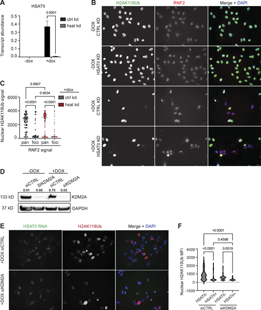HSATII RNA depletion nor KDM2A depletion does not rescue global H2AK119Ub signal. (A) Quantitative RT-PCR of gapmer-mediated HSATII RNA depletion in cells using gapmers targeting either HSATII or control sequences (Shadle et al., 2019) in −dox or +dox (4-h pulse and fixed/analyzed 20 h after induction) iDUX4 cells. HSATII transcripts are normalized to RPL27 internal control. N = 3. (B) Paired samples from A for immunofluorescence analysis of RNF2 signal (red) and H2AK119Ub signal (green) in −dox or +dox iDUX4 cells treated with HSATII− or control gapmers. Images represent one experiment. (C) Nuclear H2AUb signal intensity was calculated for nuclei that contained RNF2 pan-nuclear signal (pan) or RNF2 aggregates (foci) in HSATII or control gapmer treated cells. Nuclei are indicated for each independent experiment and N ≥ 50 nuclei per condition. (D) siRNA depletion of either KDM2A (siKDM2A) or control (siCTRL) sequences in −dox or +dox (4-h pulse and fixed/analyzed 20 h after induction) iDUX4 cells. Western blot was performed on whole-cell lysate and probed for KDM2A. GAPDH was used as loading control. Numbers above KDM2A represent signal relative to GAPDH. Blot is representative of three biological replicates per condition. (E) Paired samples from A for combined RNA-FISH and immunofluorescence of HSATII RNA signal (green) and H2AK119Ub signal (red) in +dox (4-h pulse and fixed/analyzed 20 h after induction) iDUX4 cells with (siKDM2A) or without (siCTRL) KDM2A depletion. Images represent one experiment. (F) Nuclear H2AUb MFI was calculated in +dox iDUX4 cells with (siKDM2A) or without (siCTRL) KDM2A depletion in nuclei that contained no HSATII RNA (HSATII−) or HSATII RNA foci (HSATII+). Nuclei are indicated for representative experiment and N ≥ 50 nuclei per condition. (A, C, and F) Data represent means ± SD. Statistical differences between groups were analyzed with one-way ANOVA Tukey’s multiple comparison test or two-way ANOVA Sidak’s multiple comparison test or were assessed with Kruskal–Wallis test between each group and a control. Source data are available for this figure: SourceData FS2.