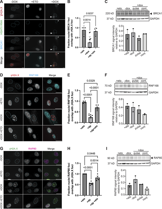 DUX4 expression impacts DNA damage response factor recruitment to sites of damage. (A) Combined RNA-FISH and immunofluorescence of HSATII RNA (green), γH2A.X (red), and BRCA1 (cyan) signal in −dox, treated with 10 μM etoposide for 30 min and immediately fixed (+eto), briefly induced with 2 μg/ml doxycycline for 4 h and fixed 20 h after induction (+dox) iDUX4 cells (scale bar = 20 μm). Arrow indicates nuclei with γH2A.X foci and HSATII RNA but lacks BRCA1 foci formation at sites of damage. Asterisk indicates nuclei with γH2A.X foci and BRCA1 foci formation at sites of damage in HSATII− nuclei. Images are representative of two independent experiments conducted on separate days. (B) Fraction nuclei with BRCA1 foci formation at DNA damage sites (γH2A.X foci) in −dox, +eto and +dox either in HSATII− or HSATII+ nuclei. Dots represent fields taken from representative experiments. N ≥ 50 nuclei per condition. (C) Western blot of whole cell lysate probing BRCA1 total protein in +eto, −dox, pulsed, or continuous dox-treated cells. The blot shows two biological replicates. Note that I uses the same GAPDH control image because the same western membrane was used to probe for BRCA1 and RAP80. (D) Immunofluorescence of γH2A.X (red) and RNF168 (cyan) signal in −dox, treated with 10 μM etoposide for 30 min and immediately fixed (+eto), briefly induced with 2 μg/ml doxycycline for 4 h and fixed 20 h after induction (+dox), or briefly induced with 2 μg/ml doxycycline for 4 h and at 20 h after induction treated with 10 μM etoposide for 30 min and then immediately fixed (+dox +eto) iDUX4 cells (scale bar = 20 μm). Images are representative from two independent experiments conducted on separate days. (E) Fraction nuclei with RNF168 foci formation at DNA damage sites (γH2A.X foci) in +eto, +dox pulse (+dp), and +dp +eto cells. Dots represent the average of fields taken from a representative experiment. N ≥ 50 nuclei per condition. (F) Western blot of whole cell lysate probing RNF168 total protein in +eto, −dox, pulsed, or continuous dox treated cells. The blot shows two biological replicates. Note that Fig. 6 F uses the same GAPDH control image because the same western membrane was used to probe for RAD51 and RNF168. (G) Immunofluorescence of γH2A.X (green) and RAP80 (magenta) signal in −dox, +eto, +dox, and +dox +eto iDUX4 cells, (scale bar = 20 μm). Images are representative of two independent experiments conducted on separate days. (H) Fraction nuclei with RAP80 foci formation at DNA damage sites (γH2A.X foci) in +eto, +dox pulse (+dp), and +dp +eto cells. Dots represent the average of fields taken from a representative experiment. N ≥ 50 nuclei per condition. (I) Western blot of whole cell lysate probing RAP80 total protein in +eto, −dox, pulsed, or continuous dox treated cells. The blot shows two biological replicates. Note that C uses the same GAPDH control image because the same western membrane was used to probe for BRCA1 and RAP80. (B, E, and H) Data represent means ± SD. Statistical differences between groups were analyzed with one-way ANOVA Tukey’s multiple comparison test between each group and a control. Source data are available for this figure: SourceData FS3. Refer to the image caption for details.