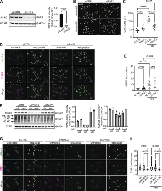 KDM2 proteins and PRC1 components are required for 53BP1 foci formation and/or H2AUb signaling following DNA damage. (A) Quantification of total RNF2 protein levels in control knockdown (siCTRL) or in RNF2-depleted cells (siRNF2). The blot shows three biological replicates. Protein levels were normalized to loading control (GAPDH). (B) Representative immunofluorescence images of H2AUb signal (gray) within siCTRL cells or siRNF2 cells either left untreated or treated briefly with 10 μM etoposide. Scale bar = 20 μm. Images are representative of three independent experiments conducted on separate days. N ≥ 100 nuclei imaged. (C) Quantification of nuclear H2AUb signal intensity in siCTRL or siRNF2 cells with or without etoposide treatment. Dots represent the number of nuclei measured. Nuclei are indicated for representative experiment and N ≥ 25 nuclei per condition. (D) Representative immunofluorescence images of γH2A.X (green) and 53BP1 (magenta) within siCTRL cells or siRNF2 cells either left untreated or treated briefly with 10 μM etoposide. Scale bar = 20 μm. Images are representative from three independent experiments conducted on separate days. N ≥ 100 nuclei imaged. (E) Quantification of the number of 53BP1 foci per nucleus in siCTRL or siRNF2 cells with or without etoposide treatment. Nuclei are indicated for representative experiment and N ≥ 25 nuclei per condition. (F) Western blot of whole cell lysate probing for total KDM2A and KDM2B protein levels in control knockdown (siCTRL), KDM2A-depleted cells (siKDM2A), or KDM2B-depleted (siKDM2B) cells. Blot shows two biological replicates. Protein levels were normalized to loading control (GAPDH). (G) Representative immunofluorescence images of γH2A.X (green) and 53BP1 (magenta) within siCTRL, siKDM2A, or siKDM2B cells either left untreated or treated briefly with 10 μM etoposide. Scale bar = 20 μm. Images are representative of two independent experiments conducted on separate days. N ≥ 100 nuclei imaged. (H) Quantification of the number of 53BP1 foci per nucleus in siCTRL, siKDM2A, or siKDM2B cells with or without etoposide treatment. Nuclei are indicated for representative experiment and N ≥ 50 nuclei per condition. (A, C, E, and H) Data represent means ± SD. Statistical differences between groups were analyzed with one-way ANOVA Tukey’s multiple comparison or Dunnett’s multiple comparison test between each group and a control. Source data are available for this figure: SourceData FS5. Refer to the image caption for details.