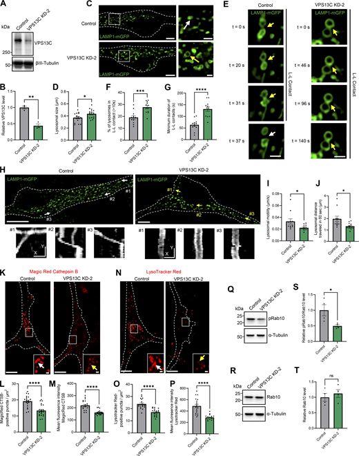 Validation of lysosomal phenotypes with additional independent shRNA targeting VPS13C in iPSC-derived dopaminergic neurons. (A and B) Representative immunoblot and quantification of VPS13C KD (KD-2) efficiency in hiPSC-derived dopaminergic neurons (day 70) after 14 days of control and VPS13C shRNA treatment (N = 3). (C) Representative live-cell confocal images of LAMP1-mGFP (green) -positive vesicles in control (upper) and VPS13C KD-2 (lower) neurons with insets showing enlarged lysosomes (yellow arrow) in VPS13C KD-2 condition in comparison with lysosomes in control condition (white arrow) (scale bar: 10 µm, inset: 1 µm). (D) Quantification of the average lysosomal size (N = 4, from n = 17 cells). (E) Time-lapse images of L-L contacts showing tethered lysosomes (yellow arrows) that untether at 37 s (white arrows) in control condition but remain tethered in VPS13C KD-2 neurons until 140 s (yellow arrow) (scale bar: 1 µm). (F) Quantification of the percentage of lysosomes in stable L-L contacts (≥10 s). (G) Quantification of the minimum duration of L-L contacts (N = 4, from n = 12 cells). (H) Representative live-cell confocal images showing LAMP1-positive vesicles (green) and examples of lysosomal motility demonstrated by kymographs (bottom panels) in control and VPS13C KD-2 neurons (scale bar: 10 µm, kymograph scale bar: x = 1 µm, y = 20 s). (I and J) Quantification of the average distance traveled by lysosomes in 60 s and the average lysosomal motility N = 4, from n = 11 cells (control) and n = 13 cells (VPS13C KD-2). (K) Representative live-cell confocal images of Magic Red cathepsin B staining in control neurons showing stronger cathepsin B intensity (white arrow) and in VPS13C KD-2 neurons showing reduced cathepsin B intensity (yellow arrow) Scale bar: 10 µm, inset: 1 µm. (L and M) Quantification of the number of Magic Red cathepsin B-positive puncta per cell area (L) and the mean fluorescence intensity of Magic Red cathepsin B-positive puncta (M) (N = 4, from n = 22 cells). (N) Representative live-cell confocal images of LysoTracker Red DND-99 staining in control neurons showing stronger LysoTracker intensity (white arrow) and in VPS13C KD-2 neurons showing reduced LysoTracker intensity (yellow arrows). Scale bar: 10 µm, inset: 1 µm. (O and P) Quantification of the number of LysoTracker Red-positive puncta per cell area (O) and the mean fluorescence intensity of LysoTracker Red-positive puncta (P) (N = 4, from n = 19 cells). (Q–T) Representative immunoblots and quantifications of phospho-Rab10 (pRab10) and total Rab10 protein levels from whole cell HEK-293 FT lysates (N = 4). Dashed lines in C, H, K, and N represent the outline of the cell. Data collected for the non-targeting control condition were used for the comparison between control and KD-1 in Figs. 1, 2, 3, 6, and 7, and for the comparison between control and KD-2 in Fig. S5. Data represented as mean ± SEM; unpaired two-tailed t test (B, D, F, G, I, J, L, M, O, P, S, and T); ns: not significant (T), *P < 0.05 (D, I, J, and S), **P < 0.01 (B), ***P < 0.001 (F), ****P < 0.0001 (G, L, M, O, and P). Source data are available for this figure: SourceData FS5. Refer to the image caption for details.