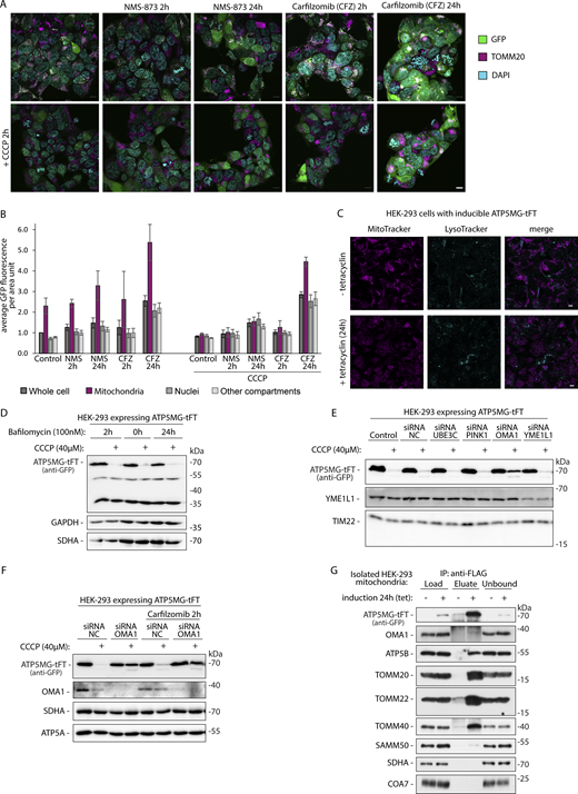 Related toFigs. 4 and 6. (A) Confocal imaging of HEK-293 cells expressing ATP5MG-tFT treated with NMS-873 or Carfilzomib with and without CCCP as indicated. ATP5MG-tFT expression was induced for 24 h and detected by GFP fluorescence. Cells were immunolabeled using antibodies against TOMM20, and cell nuclei were stained with DAPI. Scale bars: 10 μm. (B) Quantification of GFP fluorescence intensity from panel A, in different cellular compartments. Quantification was conducted as shown in Fig. S3 D. Graphs present means ± SD, n = 3 independent experiments. (C) Confocal imaging of HEK-293 cells with or without 24 h tetracycline induction of ATP5MG-tFT expression. Cells were live-stained with Lysotracker and Mitotracker Deep Red FM. Scale bar: 5 μm. (D) ATP5MG-tFT levels in HEK-293 cells are not affected by autophagy inhibition using bafilomycin (100 nM). (E) Representative western blot results used to calculate the impact of siRNAs targeting selected mitochondrial proteases presented in Fig. 6 C. HEK-293 cells with ATP5MG-tFT were treated with indicated siRNA for 48 h, fusion protein expression was induced for 24 h using tetracycline, and finally, cells were treated with or without CCCP for 2 h. Western blot signal representing full-size fusion was used for quantification. (F) HEK-293 cells with ATP5MG-tFT were treated with siRNA targeting OMA1 as in E. In addition to CCCP treatment, proteasome inhibitor Carfilzomib was applied as indicated. (G) Lysates of mitochondria isolated from HEK-293 cells with or without ATP5MG-tFT expression induction were immunoprecipitated with anti-FLAG beads. Samples were analyzed using SDS-PAGE and immunoblotting with the indicated antibodies (load, 2.5%; eluate, 100%; unbound, 2.5%). Source data are available for this figure: SourceData FS4. Refer to the image caption for details.