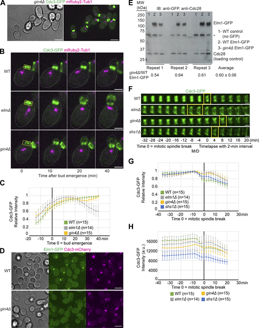 Septins exhibit mild bud neck displacement while Elm1 is absent from the bud neck in gin4∆ cells. (A) Representative images of YEF9641 (gin4∆ CDC3-GFP mRuby2-TUB1) cells with brightfield (left) and maximum-intensity projection of merged Cdc3-GFP in green and mRuby2-Tub1 in magenta (right). Scale bar = 5 μm. (B) Maximum-intensity projection images of representative WT (YEF9180), elm1∆ (YEF9935), and gin4∆ (YEF9641) cells from a time-lapse series taken with a 2-min interval with Cdc3-GFP in green and mRuby2-Tub1 in magenta at indicated times. T = 0 is bud emergence, gray dashed line is the cell periphery, yellow boxed region is the area used for measurements in C, scale bars = 2 μm. (C) Quantification of cells in B. Shown is the background subtracted intensity of Cdc3-GFP in WT (green), elm1∆ (gray), and gin4∆ (yellow) relative to the maximum value measured from the sum projection of the given number of cells for each strain. The mean is plotted with error bars being the SD. (D) Representative images of Elm1-GFP and Cdc3-mCherry in WT (YEF10440) and gin4∆ (YEF10460) cells with brightfield (left) and maximum-intensity projection of Elm1-GFP in green (middle) and Cdc3-mCherry in magenta (right). Scale bars = 5 μm. (E) Top: Immunoblot (IB) analysis of Elm1-GFP and Cdc28 from three independent replicates of total protein isolates from WT (YEF9327, sample 1), Elm1-GFP (YEF10749, sample 2), and gin4∆ Elm1-GFP (YEF10750, sample 3) cells. MW = protein marker with indicated sizes in kDa at indicated positions. Asterisk (*) indicates a non-specific band from the anti-GFP antibody. Bottom: Quantification of the ratio of Elm-GFP/Cdc28 band intensity in gin4∆ samples relative to that of WT Elm1-GFP samples for each replicate. The average is presented from the three replicates ± SD. (F) Montages of representative WT (YEF9180), elm1∆ (YEF9935), gin4∆ (YEF9641), and shs1∆ (YEF8438) cells showing maximum-intensity projections of Cdc3-GFP in green from 32 min before to 20 min after mitotic spindle break with selected frames from time-lapse series taken with a 2-min interval. T = 0 is mitotic spindle break. Scale bars = 1 μm. (G) Quantification of cells in F. Shown is the background subtracted intensity of Cdc3-GFP in WT (green), elm1∆ (gray), gin4∆ (yellow), and shs1∆ (blue) relative to the maximum value measured from the sum projection of the given number cells for each strain. The mean is plotted with error bars being the SD. (H) Quantification of cells in F. Shown is the background subtracted intensity of Cdc3-GFP in WT (green), elm1∆ (gray), gin4∆ (yellow), and shs1∆ (blue) relative to the region of interest’s area measured from the sum projection of given number cells for each strain. The mean is plotted with error bars being the SD. a.u. = arbitrary units. Source data are available for this figure: SourceData F3.