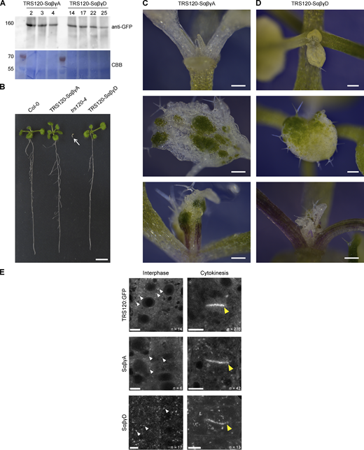 Characterization and localization of TRS120:GFP phosphovariants. (A) Western blot depicting protein expression of the phosphovariants TRS120-SαβγA and TRS120-SαβγD in trs120-4/trs120-4. Presence of the GFP-fused phosphovariants was detected with an anti-GFP antibody (upper panel). Shown are the expression levels in different primary transformants for each variant. Loaded protein amounts are shown by the corresponding CBB staining (Coomassie stain, lower panel). Protein sizes are given in kDa on the left. (B) Complementation analysis. The TRS120-SαβγA and TRS120-SαβγD phosphovariants in trs120-4/trs120-4 could rescue the null trs120-4 seedling lethal phenotype (third seedling from the left; white arrow) and did not differ from the wild-type Col-0 control in the T1 and T2 generations. Kanamycin selection was used to select for the presence of the phosphovariant construct. Images taken 13 days after stratification. Scale bar is 1 cm. (C and D) Silencing of the phosphovariant constructs upon propagation beyond the T2 generation. 2-week-old seedlings were imaged using a camera-equipped binocular microscope. (C) TRS120-SαβγA and (D) TRS120-SαβγD seedlings grown on kanamycin had some white sectors due to loss of chlorophyll in the shoot apical meristem and first true leaves; this was presumably due to gene silencing. Scale bars represent 200 µm. (E) Localization patterns of TRS120:GFP phosphovariants in root tip cells of light-grown seedlings. Confocal Scanning Laser Microscopy. PTRS120::TRS120:GFP (Rybak et al., 2014) and phosphovariants thereof. Scale bars represent 5 µm. Wild-type TRS120 resides in the cytosol and at the TGN, it labels endomembrane compartments (white arrowheads) and the cell plate (yellow arrowhead); the phosphovariants have a similar appearance. Sample numbers n = interphase or cytokinetic cells imaged. 44 TRS120-WT, 13 -SαβγA, and 10 -SαβγD root tips were imaged. Source data are available for this figure: SourceData FS11.