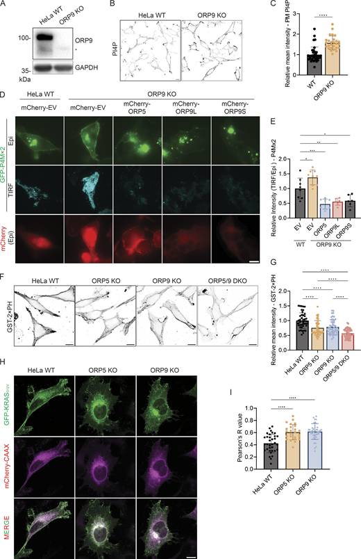 PM PI4P and PS levels are altered in ORP9-deficient cells. (A) Validation of the ORP9 KO cell line by Western blot analysis. GAPDH was included as a loading control. *Nonspecific band. (B) Representative confocal images of PM PI4P in HeLa WT or ORP9-deficient cells. The PM pool of PI4P was detected by immunofluorescence with an antibody for PI4P. Scale bars = 10 µm for all images. (C) Relative mean intensity of PM PI4P staining for cells shown in B. ****, P < 0.0001 (unpaired t test, mean ± SD, n = 27–38 cells). (D) Representative TIRF and Epi images of GFP-P4Mx2 in HeLa WT or ORP9-deficient cells co-transfected with mCherry empty vector (EV), mCherry-ORP5, mCherry-ORP9L, or mCherry-ORP9S for 24 h. Scale bars = 10 µm for all images. (E) Relative intensity of P4Mx2 (TIRF/Epi) of cells shown in D. *, P < 0.05; **, P < 0.01; ***, P < 0.001 (ordinary one-way ANOVA with Dunnett’s multiple comparisons test, mean ± SD, n = 6–9 cells). (F) PM PS labeling by GST-2xPH in HeLa WT, ORP5-deficient, ORP9-deficient, or ORP5 and ORP9 double KO cells. (G) Relative mean GST-2xPH intensity of cells shown in F. ****, P < 0.0001 (ordinary one-way ANOVA with Dunnett’s multiple comparisons test, mean ± SD, n = 44–61 cells). (H) Representative confocal images of GFP-KRASG12V in HeLa WT, ORP5-deficient, or ORP9-deficient cells co-transfected with mCherry-CAAX for 24 h. Scale bars = 10 µm for all images. (I) Pearson’s R (correlation coefficient) values of GFP-KRASG12V and mCherry-CAAX for cells shown in H. ****, P < 0.0001 (ordinary one-way ANOVA with Dunnett’s multiple comparisons test, mean ± SD, n = 25–38 cells). Source data are available for this figure: SourceData F2.