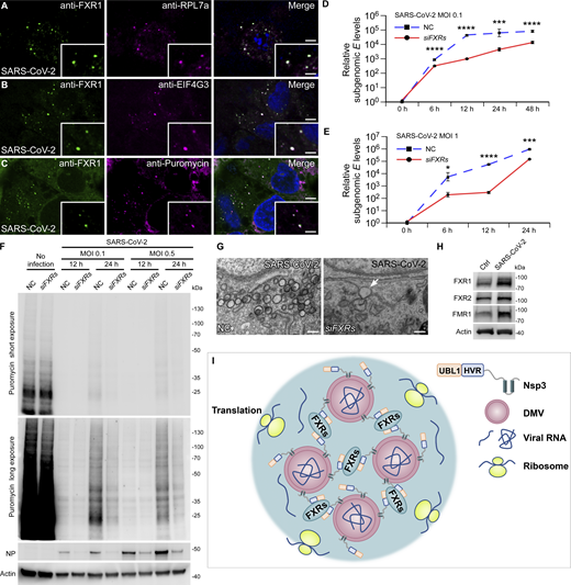 FXRs promote viral replication. (A and B) Signals from the ribosome component RPL7a (A) and translation initiation factor EIF4G3 (B) are detected at FXR1 punctate structures after 24 h SARS-CoV-2 infection with MOI = 1. Images are representative of at least 10 cells. Bars: 5 μm; insets, 2 μm. (C) After 24 h SARS-CoV-2 infection with MOI=1, ACE2-HeLa cells were treated with 10 μg/ml puromycin for 30 min. Puromycin signals colocalize with FXR1 foci. Images are representative of at least 10 cells. Bar: 5 μm; inset, 2 μm. (D and E) Levels of viral subgenomic E RNA are significantly decreased in cells depleted of FXRs compared with control cells after SARS-CoV-2 infection with MOI = 0.1 (D) or MOI = 1 (E). Quantification data are presented as mean ± SD (n = 3). *, P < 0.05; ***, P < 0.001; ****, P < 0.0001. (F) Puromycin incorporation assays with ACE2-HeLa cells show that signals from anti-puromycin antibody are dramatically suppressed upon SARS-CoV-2 infection for 12 h. After 24 h infection, slightly recovered anti-puromycin signals are detected in NC-treated but not siFXRs cells. Immunoblotting shows that viral NP levels are suppressed by siFXRs after 12 and 24 h SARS-CoV-2 infection with MOI = 0.1 or 0.5. (G) TEM images show clustered DMVs in control cells (NC), while DMVs (arrow) are only occasionally observed in siFXRs cells. Bars, 500 nm. (H) Immunoblotting shows that FXR1, FXR2, and FMR1 levels are dramatically increased after 8 h SARS-CoV-2 infection with MOI = 1. (I) The schematic model shows that LLPS of FXRs drives clustering of DMVs via interaction with the UBL1 and HVR domains of Nsp3, which further facilitates recruitment of translation machinery for viral replication. Source data are available for this figure: SourceData F7.