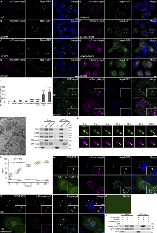 FXRs are essential for DMV clustering, related toFigs. 2 and 3. (A–H) Compared with NC-treated cells (A), the number of Nsp3/4+ puncta is slightly increased in siFXR1, siFXR2, siFMR1, siFXR1/2, or siFXR2/FMR1 cells (B–F). Cells with double KD of FXR1 and FMR1 show an obvious increase in the number of Nsp3/4+ puncta (G). Depleting all FXR genes causes dramatic DMV dispersion (H). Bars: 10 μm. (I) Numbers of DMVs are shown as mean ± SD (NC, n = 25; siFXR1, n = 35; siFXR2, n = 34; siFMR1, n = 35; siFXR1/2, n = 32; siFXR2/FMR1, n = 41; siFXR1/FMR1, n = 38; siFXRs, n = 39). *, P < 0.05; ***, P < 0.001; ****, P < 0.0001. (J) Fluorescence images reveal numerous small Nsp3/4+ puncta in cells coexpressing GFP-Nsp6, mCherry-Nsp3, and Nsp4-BFP after KD of all FXR genes, while a few big Nsp3/4+ puncta are formed in control cells. Images are representative of at least 10 cells. Bars: 5 μm; insets, 2 μm. (K) TEM images show that dispersed DMVs are observed in siFXRs cells coexpressing GFP-Nsp6, mCherry-Nsp3, and Nsp4-BFP, while clustered DMVs are present in NC-treated cells. Bars: 500 nm. (L) In a GFP-Trap assay, FXR1, FXR2, and FMR1 are immunoprecipitated by GFP-Nsp3, but not Nsp6. (M and N) FRAP results show that after photobleaching part of a punctum (arrows), most of the GFP-FXR1 fluorescent signal recovers, while the mCherry-Nsp3 signal fails to recover (M). Quantitative data are presented as mean ± SEM (n = 12) in N. Bars: 2 μm. (O) GFP-FXR1 with the L351P mutation, which disrupts the phase separation ability of FXR1, fails to accumulate at Nsp3/4+ sites. Images are representative of at least 10 cells. Bars: 5 μm; insets, 2 μm. (P) Most of the GFP-FXR1 signal is diffuse in cells treated with 1,6-hexanediol. Images are representative of at least 10 cells. Bars: 5 μm; insets, 2 μm. (Q) Nsp3N does not form liquid droplets in vitro. Bar: 5 μm. (R) In a GFP-Trap assay, mCherry-Nsp3 is precipitated by GFP-FXR1, but not GFP-FXR1(L351P). Source data are available for this figure: SourceData FS2.