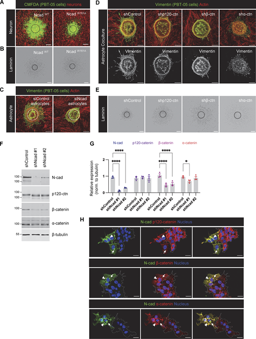 Role of intercellular N-cad homotypic interactions and importance of N-cad for catenin localization. (A and B) Representative images of NcadWT and NcadW161A expressing PBT-05 cells migrating on cerebellar neurons or laminin. (C) Representative images of PBT-05 cells migrating on control or N-cad siRNA-treated mouse astrocytes. Scale bars, 200 μm. (D and E) Images of PBT-05 cells expressing control, p120-catenin (p120-ctn), β-catenin (β-ctn), or α-catenin (α-ctn) shRNAs, migrating on mouse astrocytes or laminin. Scale bars, 200 μm. (F and G) N-cad, p120-catenin β-catenin, and α-catenin protein levels in control and N-cad-depleted cells. Protein expression levels were normalized to β-tubulin as a loading control. Two-way ANOVA uncorrected Fisher’s LSD test. N = 3 Western blots. Error bars show mean ± SEM. *P < 0.05, ****P < 0.0001. (H) Localization of p120-catenin, β-catenin, and α-catenin in control or N-cad-depleted cells. Dashed lines indicate clusters of N-cad-depleted cells. Arrowheads indicate cell-cell junctions and arrows indicate intracellular vesicles. Scale bars, 20 μm. Source data are available for this figure: SourceData FS2.