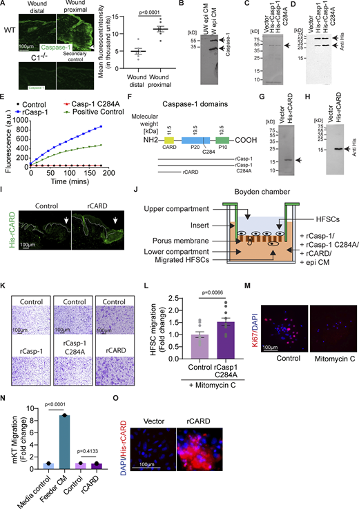 Characterization of the effect of Caspase-1 on HFSC migration. (A) Staining for extracellular Caspase-1 (green) in a wound distal and wound proximal area of WT skin sections. C1−/− skin section stained for extracellular Caspase-1 in similar conditions is presented for comparison. Secondary antibody control is presented to show the background fluorescence. Graph is the quantification of the background-subtracted mean fluorescent intensity of WT skin sections in wound distal and the wound proximal regions taken from at least three mice (Wound distal, n = 6; Wound proximal, n = 7). Mean ± SEM are reported, and P value is calculated by unpaired, one-tailed Student’s t test. Arrow marks the wound edge. (B) Full Western blot of unwounded and wounded epidermal conditioned media probed with antibody against Caspase-1. (C) Silver nitrate staining of purified histidine-tagged recombinant wild-type Caspase-1 (His-rCasp-1) and catalytically dead Caspase-1 (His-rCasp-1 C284A) on a denaturing acrylamide gel. Arrows point to the expected position of the protein of interest. (D) Full Western blot of purified recombinant histidine-tagged wild-type Caspase-1 (His-rCasp-1) and catalytically dead Caspase-1 (His-rCasp-1 C284A) probed with anti-His antibody. (E) Measurement of caspase-1 catalytic activity in a substrate cleavage assay of both the rCasp-1 and rCasp-1 C284A in comparison with HaCat cell lysate (Positive control). An increase in fluorescence upon substrate (Ac-YVAD-AMC) cleavage is plotted on the y-axis. (F) Domain structure of Caspase-1, indicating the constructs being expressed. (G) Silver nitrate staining of purified histidine-tagged rCARD (His-rCARD) on a denaturing acrylamide gel. (H) Full Western blot of purified histidine-tagged rCARD (His-rCARD) probed with anti-His antibody. Arrow points the expected position of protein of interest. (I) Immunofluorescent image of a wounded caspase-1 null mouse skin section probed with anti-His antibody to detect rCARD. Arrow marks the wound edge. (J) Schematic of Boyden chamber/transwell migration assay. (K) Representative images of migrated HFSCs in the Boyden chamber. (L) Proliferation inhibited HFSC (upon Mitomycin treatment) chemotaxis using a Boyden chamber/transwell assay towards rCasp-1 C284A in comparison with the vector control. Quantifications are from at least three pooled independent replicates (Control, n = 12; rCasp-1 C284A, n = 12). Mean ± SEM are reported, and P value is calculated by unpaired, one-tailed Student’s t test. (M) Immunofluorescence images of mitomycin C treated HFSCs probed with the proliferation marker-Ki67 (red). (N) Primary mouse keratinocyte (mKT) chemotaxis using a Boyden chamber toward rCARD in comparison with the vector control. Media control induces no migration and is the benchmark for basal migration of cells with no chemoattractant. Feeder cell-conditioned media (Feeder CM) was used as a positive control for inducing migration. Quantification is from two independent biological replicates. Mean ± SEM are reported, and P values are calculated by one-way ANOVA. (O) Binding of His-tagged rCARD onto hair follicle stem cells visualized by anti-His antibody staining (red). rCARD was applied on hair follicle stem cells grown in tissue culture plate and incubated at room temperature. Unbound CARD was washed off. Source data are available for this figure: SourceData FS1. Refer to the image caption for details.