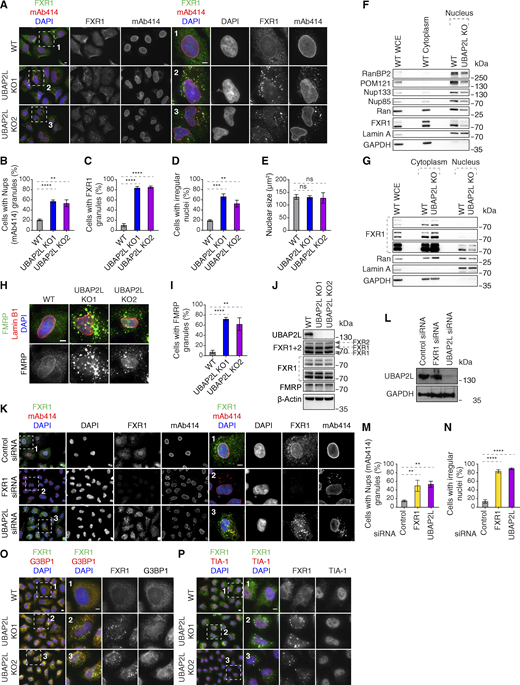 UBAP2L regulates FXRP proteins in the cytoplasm. (A–E) Representative immunofluorescence images depicting the nuclear shape and localization of Nups (mAb414) and FXR1 in WT and UBAP2L KO HeLa cells in interphase cells synchronized by DTBR at 12 h. The magnified framed regions are shown in the corresponding numbered panels. Nuclei were stained with DAPI. Scale bars, 5 μm (A). The percentage of cells with cytoplasmic granules of Nups (mAb414) (B) and of FXR1 (C) and with irregular nuclei (D) and the nuclear size (E) shown in A were quantified. At least 250 cells per condition were analyzed (mean ± SD, ns: non-significant, **P < 0.01, ***P < 0.001, ****P < 0.0001, unpaired two-tailed t test, n = 3 independent experiments). (F) The nuclear and cytoplasmic protein levels of Nups and NPC transport-associated factors in WT and UBAP2L KO HeLa cells synchronized as in A were analyzed by western blot. WCE indicates whole cell extract. (G) The nuclear and cytoplasmic protein levels of Nups and NPC transport-associated factors in asynchronously proliferating WT and UBAP2L KO HeLa cells were analyzed by western blot. WCE indicates whole cell extract. (H and I) Representative immunofluorescence images depicting the localization of FMRP and Lamin B1 in WT and UBAP2L KO HeLa cells synchronized in interphase by DTBR at 12 h. Nuclei were stained with DAPI. Scale bar, 5 μm (H). The percentage of cells with the cytoplasmic granules containing FMRP shown in H was quantified (I). At least 200 cells per condition were analyzed (mean ± SD, **P < 0.01, ****P < 0.0001, unpaired two-tailed t test, n = 3 independent experiments). (J) The protein levels of FXRP proteins in WT and UBAP2L KO HeLa cells synchronized in interphase by DTBR at 12 h were analyzed by western blot. (K–N) Representative immunofluorescence images depicting localization of FXR1 and Nups (mAb414) and the nuclear shape in the HeLa cells treated with indicated siRNAs and synchronized in interphase by DTBR at 12 h. The magnified framed regions are shown in the corresponding numbered panels. Nuclei were stained with DAPI. Scale bars, 5 μm (K). UBAP2L protein levels in K were analyzed by western blot (L). The percentage of cells with the cytoplasmic granules of Nups (mAb414) (M) and irregular nuclei (N) shown in K were quantified. At least 200 cells per condition were analyzed (mean ± SD, **P < 0.01, ****P < 0.0001, unpaired two-tailed t test, n = 3 independent experiments). (O and P) Representative immunofluorescence images of WT and UBAP2L KO HeLa cells synchronized in interphase by DTBR at 12 h under non-stress conditions depicting localization of FXR1 (O and P), G3BP1 (O), and TIA-1 (P). The magnified framed regions are shown in the corresponding numbered panels. Nuclei were stained with DAPI. Scale bars, 5 μm. Note that FXR1-containing granules present in non-stressed UBAP2L KO HeLa cells do not colocalize with SG components. Source data are available for this figure: SourceData FS3. Refer to the image caption for details.