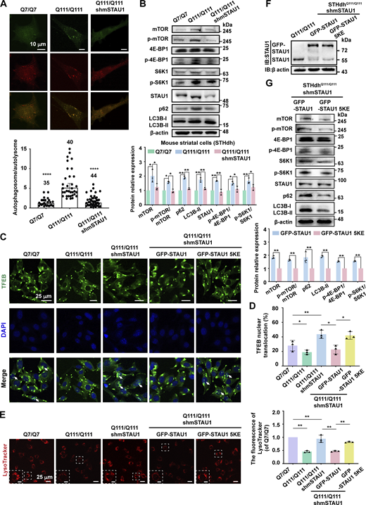 STAU1 LLPS enhances mTOR signaling and impairs autophagy flux in HD cell line. (A) Upper: Representative images of autophagic flux measurement in STHdh cells expressing the mRFP-GFP-LC3 reporter. Scale bar, 10 μm. Lower: Statistic graph of mRFP-GFP-LC3 tandem assay showing an increased autophagosome/autolysosome ratio in STHdhQ111/Q111 cells compared with STHdhQ7/Q7 cells, indicating low autophagic flux. STAU1 depletion resulted in a decreased autophagosome/autolysosome ratio in STHdhQ111/Q111 cells. n, number of individual cells (on the top of the batch). Statistics data are presented as the mean ± SEM; ****P < 0.0001 using one-way ANOVA with Tukey’s multiple comparison test. (B) Upper: Representative WB images showing HD cell line (STHdhQ111/Q111) is autophagy-defective compared to WT cells (STHdhQ7/Q7) and STAU1 depletion lowers protein levels of mTOR and other autophagy pathway proteins. Lower: Statistic graph of quantified fold changes. (C) Representative immunofluorescence images showing the distribution of TFEB in WT (STHdhQ7/Q7), HD (STHdhQ111/Q111), STHdhQ111/Q111-STAU1-KD, and DOX-induced STHdhQ111/Q111-STAU1-KD/GFP-STAU1 or GFP-STAU1 5KE cells. White arrows indicate the expression of TFEB in the nucleus. Scale bar, 25 μm. (D) Quantification of the number of cells with nuclear TFEB localization in C. Data were collected from three independent experimental batches, with >300 cells counted for each batch. (E) Representative images and quantification of Lyso-Tracker Red staining in WT (STHdhQ7/Q7), HD (STHdhQ111/Q111), STHdhQ111/Q111-STAU1-KD, and DOX-induced STHdhQ111/Q111-STAU1-KD/GFP-STAU1 or GFP-STAU1 5KE cells. Scale bar, 25 μm; insets, 10 μm. >300 cells were assessed blind and quantified. (F) Representative WB images of STAU1 expression levels in STHdhQ111/Q111 cells, DOX-induced STHdhQ111/Q111-STAU1-KD/GFP-STAU1 cells, and DOX-induced STHdhQ111/Q111-STAU1-KD/GFP-STAU1 5KE cells. (G) Upper: Representative WB images of mTOR, p-mTOR, 4EBP1, p-4EBP, S6K1, p-S6K1, p62, and LC3-II levels in STHdhQ111/Q111-STAU1-KD cells that stably expressing GFP-STAU1 or GFP-STAU1 5KE. Lower: Statistic graph of quantified fold changes. All statistical data in this figure except for A represent the results from three independent batches of experiments and are presented as mean ± SD; *P < 0.05, **P < 0.01 using one-way ANOVA with Tukey’s multiple comparison test. Source data are available for this figure: SourceData F5.