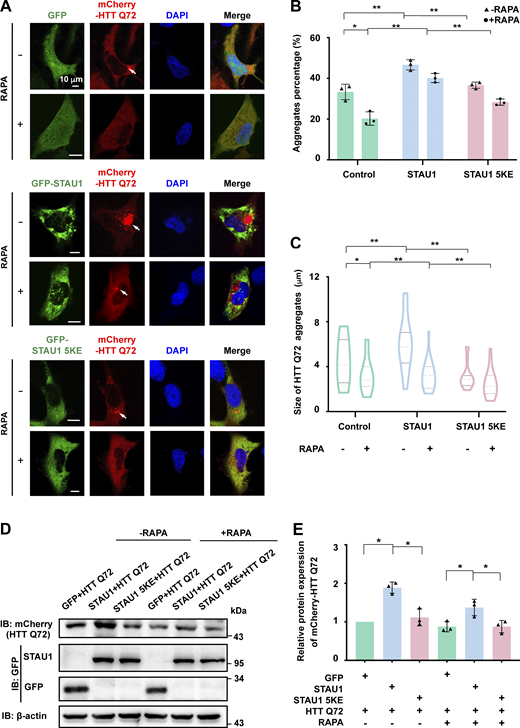 LLPS of STAU1 promotes mutant HTT aggregation in the cellular HD model. (A–C) Representative confocal images showing coexpression of mCherry-HTTexon1 Q72 with control PEGFP-C3, EGFP-STAU1 WT, or 5KE mutant in U251 cells. The mCherry-HTTexon1 Q72 transfected cells were treated with 1 μmol/l rapamycin to stimulate autophagy. Statistical data for the population of cells containing HTT Q72 aggregates or the sizes of HTT Q72 aggregates are presented in B and C, respectively. Data were collected from three independent experimental cell culture batches, with >200 cells counted for each batch. (D and E) Representative WB images of HTT Q72 in U251 cells coexpressing mCherry-HTTexon1 Q72 and control GFP-vector, EGFP-STAU1 WT, or 5KE mutant. (E) Quantification of WB bands in D for the indicated proteins using β-actin abundance for normalization and presented as fold changes. Statistics data were collected from triplicate experiments. All statistic data are presented as mean ± SD; *P < 0.05, **P < 0.01 using one-way ANOVA with Tukey’s multiple comparison test. Source data are available for this figure: SourceData F6.
