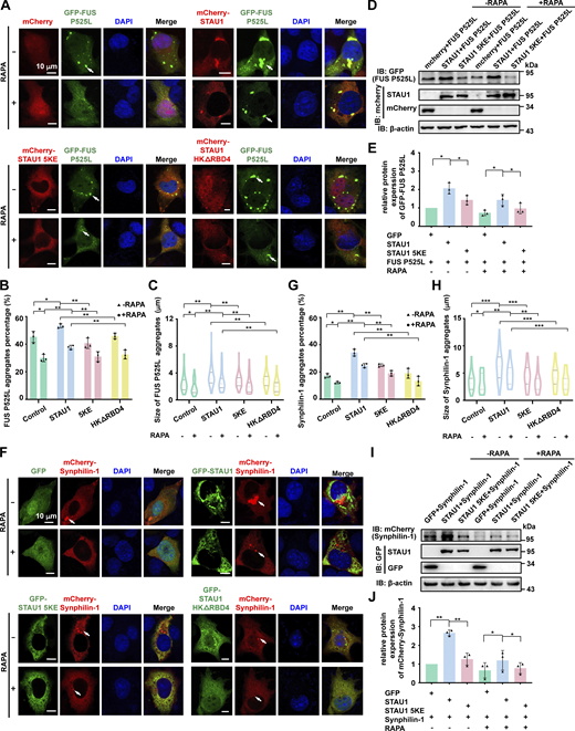 LLPS of STAU1 promotes aggregation of mutant FUS/SNCAIP in the cellular ALS/PD model. (A–C) Representative confocal images showing co-expression of EGFP-FUS P525L with control pmCherry-C1, mCherry-STAU1 WT, 5KE mutant or HKΔRBD4 mutant in COS7 cells. The EGFP-FUS P525L transfected cells were treated with 1 μmol/l rapamycin to stimulate autophagy. Statistical data for the population of cells containing FUS P525L aggregates or the sizes of FUS P525L aggregates are presented in B and C, respectively. Data were collected from three independent experimental cell culture batches, with >200 cells counted for each batch. (D–E) Representative WB images of FUS P525L in COS7 cells co-expressing EGFP-FUS P525L with control pmCherry-C1, mCherry-STAU1 WT, or 5KE. (E) Quantification of WB bands in D. The indicated proteins were normalized using β-actin abundance and presented as fold changes. Statistics data were collected from triplicate experiments. (F–H) Representative confocal images of COS7 cells cotransfected with mCherry-Synphilin-1 and control PEGFP-C3, EGFP-STAU1 WT, 5KE mutant, or HKΔRBD4 mutant. The mCherry-Synphilin-1 transfected cells were treated with 1 μmol/l rapamycin to stimulate autophagy. Statistical data for the population of cells containing SNCAIP aggregates or the sizes of SNCAIP aggregates are presented in G and H, respectively. Data were collected from three independent experimental cell culture batches, with >200 cells counted for each batch. (I and J) Representative WB images of SNCAIP in COS7 cells co-expressing mCherry-Synphilin-1 with control PEGFP-C3, EGFP-STAU1 WT, or 5KE mutant. (J) Quantification of WB bands in I. Statistical data were collected from triplicate experiments. All specimens’ statistics are presented as mean ± SD; *P < 0.05, **P < 0.01, ***P < 0.001 using one-way ANOVA with Tukey’s multiple comparison test. Source data are available for this figure: SourceData F7. Refer to the image caption for details.