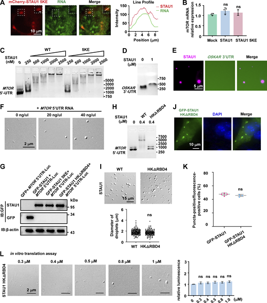 STAU1 condensate recruits MTOR mRNA to enhance its translation. (A) Left: Representative images showing co-localization of mCherry-STAU1 5KE (red) with RNA (green) within STAU1 5KE condensate (dashed box) in COS7 cells. RNA was stained with SYTO 12 Green-Fluorescent Nucleic Acid Stain. Scale bars, 10 μm; inset, 2 μm. Right: Line plot of STAU1 and RNA fluorescence intensities in indicated box regions. (B)MTOR mRNA levels in COS7 cells transfected with GFP-STAU1 WT or LLPS-deficient 5KE mutant or the empty vector (Mock) were analyzed by qRT-PCR. RNA expression levels were normalized to GAPDH. (C) Representative EMSA assay image of MTOR 5′UTR RNA (20 ng) incubated with increasing amounts of STAU1 WT or 5KE mutant in 500 mM NaCl. (D) Representative EMSA assay image of OSKAR 3′UTR RNA (20 ng) incubated with or without STAU1 (1 μM). (E) Representative images showing the droplets of Cy5-STAU1 (5 μM, magenta) could not enrich OSKAR 3′UTR (40 ng, green) stained by SYTO12. (F) Representative DIC images of STAU1 droplets with the increasing amounts of MTOR 5′UTR RNA. Images were acquired at ∼3 min after injecting the mixture into the chamber. Scale bar, 2 μm. (G) Representative Western blotting images of COS7 cells co-transfected with MTOR-5′UTR-LUC reporter and PEGFP-C3, EGFP-STAU1 WT or mutants. (H) EMSA assay image of MTOR 5′UTR RNA (20 ng) incubated with 0.4 μM of STAU1 WT or HKΔRBD4 mutant. (I) Upper: Representative images of STAU1 and STAU1 HKΔRBD4 under DIC microscope at 10 μM. Scale bar: 15 μm. Lower: Scatter plot representing the droplet size of STAU1 and STAU1 HKΔRBD4 at 10 μM. >150 droplets counted for each batch. Data are shown as mean ± SEM; ns, not significant. (J) Representative confocal images of exogenously expressed GFP-STAU1 HKΔRBD4 in COS7 cells. Scale bar: 10 μm. (K) Statistical data of GFP-STAU1 and GFP-STAU1 HKΔRBD4 puncta formation. Data were collected from three or four independent experimental cell culture batches, >300 cells counted for each batch. Specimens’ statistics are presented as mean ± SD; ns, not significant. (L) Upper: Representative DIC images of the reaction mixtures with STAU1 HKΔRBD4 mutant after the in vitro translation assay. Protein concentrations of STAU1 HKΔRBD4 are indicated on the top of the panel. Lower: Statistical data for the relative luminescence of different samples. All statistic data are presented as the mean ± SD of three independent experiments; ns, not significant. Source data are available for this figure: SourceData FS2. Refer to the image caption for details.
