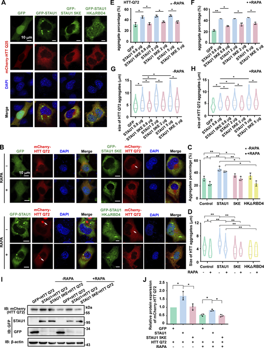 LLPS of STAU1 promotes mutant HTT aggregation in the cellular HD model. (A) Representative images showing co-expression of mCherry-HTTexon1 Q25 and PEGFP-C3, EGFP-STAU1 WT, 5KE mutant or HKΔRBD4 mutant in COS7 cells. (B) Representative confocal images showing co-expression of mCherry-HTTexon1 Q72 with control PEGFP-C3, EGFP-STAU1 WT, 5KE mutant, or HKΔRBD4 mutant in COS7 cells. The mCherry-HTTexon1 Q72 transfected cells were treated with 1 μmol/l rapamycin to stimulate autophagy. (C) Statistical data for the population of cells containing HTT Q72 aggregates. (D) Statistical data for the sizes of HTT Q72 aggregates. Data were collected from three independent experimental cell culture batches, with >200 cells counted for each batch. (E–H) COS7 cells were co-transfected with mCherry-HTTexon1 Q72 and increasing amounts of GFP-STAU1 plasmid (from 0.8 to 5 μg per well in a 12-well plate). The transfected cells were treated with 1 μmol/l rapamycin to stimulate autophagy. Statistical data of the population of cells containing HTT Q72 aggregates in COS7 cells without or with rapamycin treatment are presented in E and F, respectively. >300 cells were counted for each batch. Statistical data of the size of HTT Q72 aggregates without or with rapamycin treatment are presented in G and H, respectively. (I) Representative Western blot images of HTT Q72 in COS7 cells coexpressing mCherry-HTTexon1 Q72 and control GFP-vector, EGFP-STAU1 WT, or 5KE mutant. (J) Quantification of Western blotting bands in I for the indicated proteins using β-actin abundance for normalization and presented as fold changes. All specimens’ statistics in this figure represent the results from three independent batches of experiments are presented as mean ± SD; *P < 0.05, **P < 0.01 using one-way ANOVA with Tukey’s multiple comparison test. Source data are available for this figure: SourceData FS5. Refer to the image caption for details.