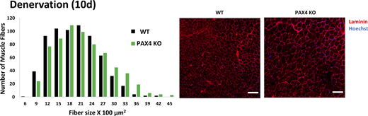 PAX4 deficiency attenuates muscle atrophy. Measurement of cross-sectional areas of 661 fibers from 10 days denervated muscles from WT versus 661 fibers from PAX KO mice. N = 3 mice. Statistics in Table S1. Right: Representative images of muscle cross sections. Fiber membrane staining (red) using laminin antibody, and nuclei staining using Hoechst. Scale bar: 50 μm.