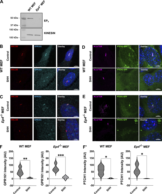 Analysis of of Ep4−/− MEFs. (A) Western blot showing expression level of EP4 in control and Ep4−/− MEFs. Kinesin is the loading control. (B and C) Confocal images of GPR161 in control and Ep4−/− MEFs are shown. GPR161 is in cyan, ARL13B (red) marks primary cilia. Scale bar = 5 μm. (D and E) Confocal images of PTCH1-GFP are shown in control and Ep4−/− MEFs following SHH stimulation. PTCH1-GFP is green and acetylated α-tubulin (magenta) marks PC. Scale bar = 5 μm. (F and F′) Quantification of ciliary signal intensity for (F) GPR161 and (F′) PTCH1. The experiment was performed twice with 20 cilia imaged per condition per experiment. Significance was determined using a Student’s t test. Significance is indicated as follows: *<0.05, **<0.01, ***<0.001. Source data are available for this figure: SourceData FS2.