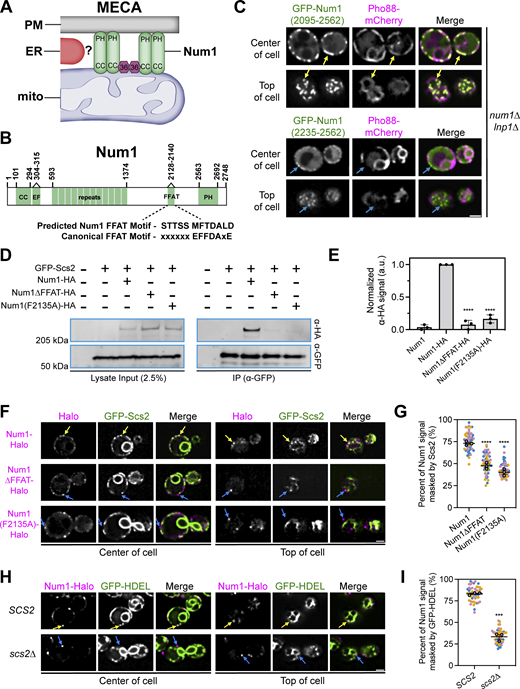 Num1 interacts with the integral ER protein Scs2 via a C-terminal FFAT motif. (A) Cartoon representation of the mitochondria–ER–cortex anchor (MECA). Num1 (green) interacts directly with mitochondrial membranes and the PM via its coiled-coil (CC) and pleckstrin homology (PH) domains, respectively. Mdm36 (purple hexagon) enhances Num1 self-association. Num1 interacts with the ER (red) via an unknown mechanism. (B) Cartoon domain schematic of Num1 comparing the predicted FFAT motif to the canonical FFAT motif. EF, EF hand-like motif. FFAT, two phenylalanines in an acidic tract. (C) Truncation analysis to identify the minimal region required to localize Num1 to the ER. The indicated Num1 truncations were expressed from the strong GPD promoter in a num1∆ lnp1∆ background. The ER was marked with Pho88-mCherry. Yellow arrows point to cortical, punctate accumulations of Num1(2095-2562) that colocalize with the ER. Blue arrows point to cortical, punctate accumulations of Num1(2235–2562) that do not colocalize with the ER. Images are single slices from the center and top of the same cell. Scale bar, 2 µm. (D) Coimmunoprecipitation of Num1, but not Num1∆FFAT or Num1(F2135A), with Scs2. Cells expressing GFP-Scs2 with the indicated Num1 alleles were lysed and subjected to affinity purification with an α-GFP antibody followed by SDS-PAGE and Western blot analysis. A representative blot of three independent experiments is shown. (E) Quantification of the coimmunoprecipitation experiments in D. For each lane, the α-HA signal at the expected Num1 MW (313 kD) was quantified and normalized to the intensity of the band from the Num1-HA lysate. Each dot represents one experimental replicate and the error bars represent SEM. To determine statistical significance, an ordinary one-way ANOVA with multiple comparisons was used (**** = P < 0.0001). All statistical analyses are in comparison to the Num1-HA condition. (F) Fluorescence micrographs of cells expressing genomically tagged Num1-Halo, Num1(F2135A)-Halo or Num1∆FFAT-Halo, and GFP-Scs2. Images are single slices from the center or top of the same cell. Individual channels are shown in grayscale. Yellow arrows indicate Num1 foci that contain Scs2 while blue arrows indicate foci that do not contain Scs2. Scale bar, 2 µm. (G) Quantification of the amount of Num1 signal that is masked by Scs2. See Materials and methods for a detailed description of the quantification methodology. Each dot represents one cell. Imaging replicates are depicted as different colors and the average of each replicate is shown as a circle of the appropriate color with a black outline. At least 50 cells per condition were measured. The horizontal line indicates the mean of the three imaging replicates with error bars representing SEM. To determine statistical significance, an ordinary one-way ANOVA with multiple comparisons was used. All statistics are in comparison to Num1 (**** = P < 0.0001). (H and I) The same as F and G except the cells expressed Num1-Halo and the ER marker GFP-HDEL in a wild type or scs2∆ background. Scale bar, 2 µm. To determine statistical significance, an unpaired t test was used (*** = P < 0.001). Source data are available for this figure: SourceData F1. Refer to the image caption for details.