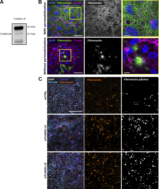 TLNRD1 in endothelial cells. (A) TLNRD1 immunoprecipitation from HUVEC lysate. A representative Western blot is displayed. (B) HUVECs were allowed to form a monolayer. Cells were then fixed and stained for DAPI, F-actin, and fibronectin (with or without permeabilization) before being imaged on a spinning disk confocal microscope. Representative maximum intensity projections are displayed. Scale bar: 250 µm. (C) TLNRD1 expression was silenced in HUVECs using two independent siRNA. HUVECs were then allowed to form a monolayer without flow stimulation. Cells were then fixed and stained for DAPI, F-actin, PECAM, and Fibronectin (without permeabilization) before being imaged on a spinning disk confocal microscope. Representative maximum intensity projections are displayed. Scale bar: 250 µm. Source data are available for this figure: SourceData FS3. Refer to the image caption for details.
