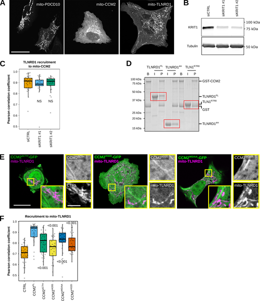 TLNRD1 interacts with CCM2. (A) U2OS cells expressing mito-PDCD10-mScarlet, mito-CCM2-mScarlet, or mito-TLNRD1-mScarlet were imaged using a spinning disk confocal microscope. (B) U2OS cells treated with siRNA targeting KRIT1 or siRNA control. KRIT1 levels were then analyzed using Western blots. A representative western blot is displayed. (C) U2OS cells treated with siRNA targeting KRIT1 or siRNA control and expressing TLNRD1-GFP and mito-CCM2-mScarlet were imaged using a spinning disk confocal microscope. 3D colocalization analyses were performed using the JACoP Fiji plugin, and results are displayed as Tukey boxplots (three biological repeats, n > 21 image stacks per condition). (D) Glutathione agarose-bound GST-CCM2 (beads: B) was incubated with recombinant TLNRD1, TLNRD14H, or TLN1R7R8 (input: I). After multiple washes, proteins bound to the beads (pellet: P) were visualized. The various fractions were then analyzed using SDS-PAGE followed by Coomassie staining. A representative gel of three independent repeats is displayed. Red boxes highlight areas of interest in the gel. (E) U2OS cells expressing various GFP-tagged CCM2 constructs and mito-TLNRD1-mScarlet or mito-mScarlet (CTRL) were imaged using a spinning disk confocal microscope. Representative single Z-planes are displayed. The yellow squares highlight magnified ROIs. Scale bars: (main) 25 µm and (inset) 5 µm. (F) 3D colocalization analyses were performed using the JACoP Fiji plugin, and results are displayed as Tukey boxplots (three biological repeats, n > 38 image stacks per condition). The whiskers (shown here as vertical lines) extend to data points no further from the box than 1.5× the interquartile range. For all panels, the P values were determined using a randomization test. NS indicates no statistical difference between the mean values of the highlighted condition and the control. Source data are available for this figure: SourceData FS5. Refer to the image caption for details.