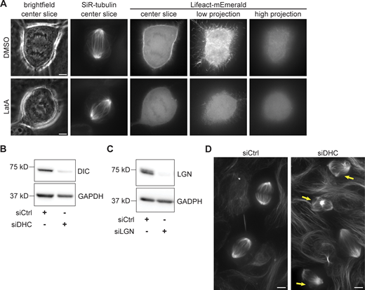 Characterization of actin, dynein, and LGN perturbations. (A) Representative images of MCF10A cells transfected with Lifeact-mEmerald for 48 h, labeled with SiR-tubulin, and treated with 500 nM LatA or an equivalent volume of DMSO for 30 min. Projection images at right represent maximum intensity projections of 5 planes spaced 0.3 µm apart, showing the regions adjacent to (low) and far from (high) the coverslip. Channels are not scaled equally between the DMSO and LatA examples, to account for differences in Lifeact-mEmerald expression level. Scale bars = 5 µm. (B) Western blot of dynein intermediate chain levels in MCF10A cells transfected with siRNA targeting luciferase (siCtrl) or dynein heavy chain for 48 h. Depletion of dynein intermediate chain is correlated with dynein heavy chain depletion (Levy and Holzbaur, 2008). GAPDH is shown as a loading control. (C) Western blot of LGN levels in MCF10A cells transfected with siRNA targeting luciferase (siCtrl) or LGN for 48 h. GAPDH is shown as a loading control. (D) Maximum intensity projections of live MCF10A cells transfected with siRNA targeting luciferase (siCtrl, left) or dynein heavy chain (siDHC, right) for 48 h and labeled with SiR-tubulin. Yellow arrows indicate metaphase spindles with abnormal morphology after dynein knockdown. Images are not scaled equally. Scale bars = 5 µm. Source data are available for this figure: SourceData FS3. Refer to the image caption for details.