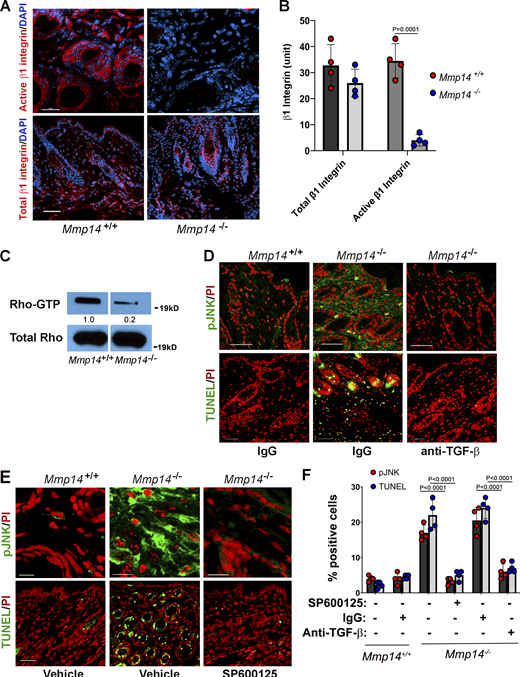 A TGF-β/JNK axis regulates Mmp14−/−dermal apoptosis in vivo. (A and B) Active and total β1 integrin expression in skin cross-sections of 3-wk-old wild-type versus Mmp14-null mice as assessed by immunofluorescence in panel A (red; bar = 50 µm) and following quantitative image analysis (B). Results are expressed as the mean ± SEM; n = 4 independent experiments as assessed by Student’s t test. (C) Western blot of Rho-GTP levels in skin extract of 3-wk-old wild-type versus Mmp14-null mice. Relative expression levels for western blots are shown as determined by densitometry. Results representative of two independent experiments performed. (D and E) pJNK and TUNEL in cross-sections of dorsal skin excised from 3-wk-old wild-type versus Mmp14-null mice treated with either IgG or anti-TGF-β neutralizing antibody (D; all bars = 50 µm) or SP600125 for 3 wk (E; pJNK, bars = 5 µm and TUNEL, bars = 50 µm). Data are representative of two independent experiments performed, each with n = 3 mice. (F) Quantification of pJNK- and TUNEL-positive cells from C and D (n = 3 independent experiments). Data are presented as mean ± SEM (n = 4 independent experiments) with P values determined by two-way ANOVA and Turkey post-test. Source data are available for this figure: SourceData F7.