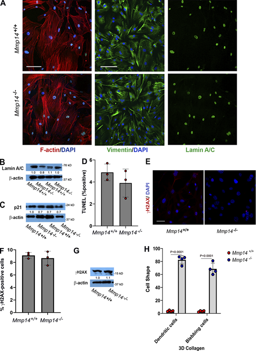 Mmp14-dependent regulation of fibroblast function in 2-D culture. (A) Confocal images of Mmp14+/+ and Mmp14−/− fibroblasts were cultured atop cover glass slips and stained for F-actin with phalloidin (DAPI counterstain), vimentin, or lamin A/C (bar = 50 µm). (B) Western blot analysis of lamin A/C expression in Mmp14+/+ fibroblasts relative to Mmp14−/− fibroblasts with GAPDH used as the loading control. Relative expression levels are shown as determined by densitometry. (C) p21 expression levels as assessed by western blot analysis in Mmp14+/+ versus Mmp14−/− fibroblasts with GAPDH used as the loading control. Relative expression levels are shown as determined by densitometry. (D)Mmp14+/+ and Mmp14−/− fibroblasts were cultured atop type I collagen hydrogels (identical to those used for 3-D culture) for 5 days and monitored for TUNEL staining (mean ± SEM; n = 3 independent experiments) as determined by Student’s t test. (E and F) Immunofluorescence staining of γ-H2AX in fibroblasts isolated from Mmp14+/+ and Mmp14−/− littermates (bar = 50 μm) (E) with the percentage of γ-H2AX–positive nuclei (mean ± SEM with P value determined by Student’s t test) quantified in 10 randomly selected high-powered fields from three independent experiments (F). (G) γ-H2AX protein expression levels in Mmp14+/+ or Mmp14−/− fibroblasts in 2-D culture as quantified by western blot, using β-actin as the loading control. Relative expression levels are shown as determined by densitometry. (H) Mmp14 wild-type and knockout cells were cultured in 3-D collagen hydrogels and the percent dendritic and blebbing cells quantified in 10 random fields in four independent experiments with results presented as mean ± SEM with P value determined by Student’s t test. Source data are available for this figure: SourceData FS2.