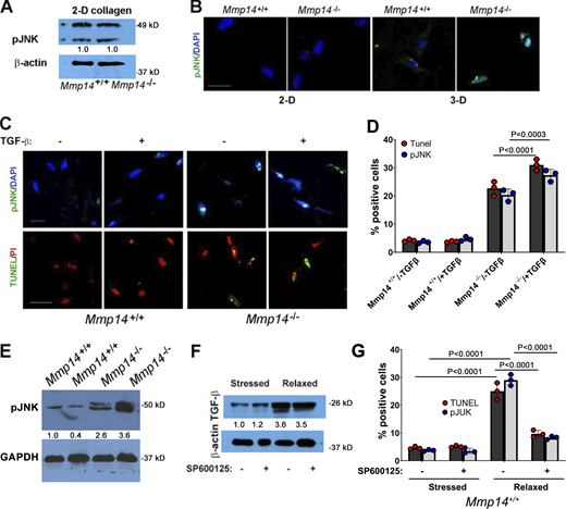 A TGF-β/JNK cascade induces fibroblast apoptosis. (A) Western blot of pJNK expression levels as assessed by western blot in lysates prepared from Mmp14+/+ or Mmp14−/− fibroblasts cultured atop (2-D) type I collagen hydrogels with β-actin used as the loading control. Results representative of two experiments performed. Relative expression levels are shown as determined by densitometry. (B) pJNK immunostaining and TUNEL staining of wild-type versus null fibroblasts in 2-D relative to 3-D collagen hydrogel culture (bar = 25 μm). Results representative of three experiments performed. (C and D)Mmp14+/+ or Mmp14−/− fibroblasts were embedded in collagen hydrogels in the absence or presence of exogenous TGF-β1 (10 ng/ml) for 5 days with JNK activation and TUNEL staining monitored by fluorescent imaging (bar = 25 µm) (C) and quantified in D (mean ± SEM; n = 3 independent experiments). Two-way ANOVA and Tukey post-test. (E) pJNK levels in dermal tissue lysates recovered from 3-wk-old wild-type versus Mmp14−/− mice (n = 2). Relative expression levels are shown as determined by densitometry. (F) TGF-β protein levels in 3-D cultures of Mmp14+/+ fibroblasts under stressed or stressed/relaxed conditions in the absence or presence of SP600125 as assessed by western blot. Results representative of three experiments performed. Relative expression levels are shown as determined by densitometry. (G)Mmp14+/+ fibroblasts were cultured in 3-D collagen hydrogels under stressed or stressed/relaxed conditions in the absence or presence of SP600125 and the number of pJNK- and TUNEL-positive cell quantified in five or more randomly selected cross-sections of the gel in three independent experiments (mean ± SEM). Two-way ANOVA and Tukey post-test. Source data are available for this figure: SourceData FS5.