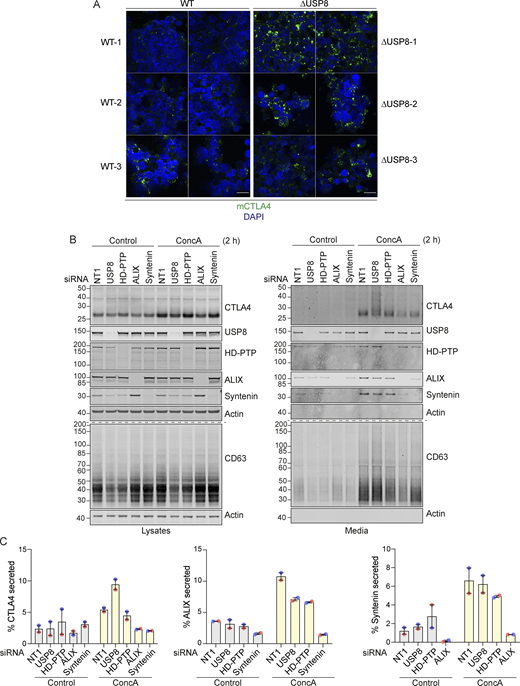 CTLA4 accumulation in USP8-deleted mouse CD4 T cells and secretion via exosomes from USP8-depleted melanoma cells. (A) Representative Airyscan images (two fields of view each) of CTLA4 co-stained with DAPI in USP8 fl/fl (WT, 1–3) and USP8 deleted (∆USP8, 1–3) activated T cells derived from individual mice. Scale bar = 15 µm. (B) A2058 cells were transfected for 72 h with non-targeting (NT1) or USP8, HD-PTP, ALIX, and Syntenin siRNAs. Lysates were collected and the cultured supernatant subjected to TCA precipitation before analysis by SDS-PAGE and western blot. (C) Quantification of CTLA4 secreted into the media for data represented in B. Individual data points from two independent, color-coded experiments are shown. Error bars indicate the range. Source data are available for this figure: SourceData FS3.