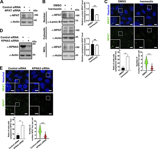 Ivermectin treatment reduces the nuclear import of NPAT. (A) Western blot analysis of endogenous NPAT expression in MCF-7 cells transfected with control or NPAT siRNA. (B) Cytoplasmic and nuclear fractions were prepared from control or ivermectin-treated MCF-7 cells and then subjected to western blot analysis to examine NPAT levels. Data in the bar graphs represent the means ± SEM values of the ratio of densities for three independent experiments. **: P < 0.01, ns: not significant. (C) Immunofluorescence staining of endogenous NPAT in MCF-7 cells treated with 50 µM ivermectin. Scale bar, 10 µm. The insets show the magnification of the boxed region (scale bar, 5 μm). The ratio of cells with NPAT foci in cytoplasm was quantified and data in the bar graphs represent the means ± SD value for three independent experiments. **: P < 0.01. The nuclear NPAT foci per cell were quantified (control: n = 170; ivermectin: n = 166). ****: P < 0.0001. (D) KPNA3 siRNA reduced the expression levels of endogenous KPNA3. (E) Immunofluorescence staining of endogenous NPAT in MCF-7 cells transfected with control or KPNA3 siRNA for 72 h. Scale bar, 10 µm. The insets show the magnification of the boxed region (scale bar, 5 μm). The ratio of cells with NPAT foci in cytoplasm was quantified and data in the bar graphs represent the means ± SD value for three independent experiments. **: P < 0.01. The nuclear NPAT foci per cell were quantified (control siRNA: n = 160; KPNA3 siRNA: n = 159). ****: P < 0.0001. Source data are available for this figure: SourceData FS2.