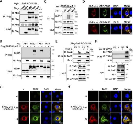 SARS-CoV-2 N protein interacts with TAB2 and TAB3. (A) Immunoprecipitation (IP) (anti-Flag) and immunoblot (IB) analysis of the interaction between Flag-TAB1/TAB2/TAB3/TAK1 and Myc-SARS-CoV-2 N protein in co-transfected HEK293T cells. (B) Immunoprecipitation (anti-Flag) and immunoblot analysis of the interaction between Flag-SARS-CoV-2 N protein and HA-TAB1/TAB2/TAB3/TAK1 in co-transfected HEK293T cells. (C) His-SARS-CoV-2 N protein, purified from E. coli, was incubated with E. coli–purified GST-TAK1/TAB2/TAB3 proteins for 6 h, the mixture was subjected to immunoprecipitation (anti-His) and immunoblot analysis. (D) HeLa cells were transfected with plasmids encoding DsRed-SARS-CoV-2 N and GFP-TAB2/TAB3 for 24 h. Nucleus marker DAPI (blue), DsRed-SARS-CoV-2 N (red), and GFP-TAB2/TAB3 (green) were then visualized with confocal microscopy. Scale bars, 10 μm. (E) HEK293T cells were transfected with the plasmid encoding Flag-SARS-CoV-2 N protein for 48 h, followed by TNF-α treatment for 4 h. Lysates were subjected to immunoprecipitation (anti-SARS-CoV-2 N protein) and immunoblot analysis. (F) Caco-2 cells were infected with SARS-CoV-2 at an MOI of 0.02 for 24 h. Lysates were subjected to immunoprecipitation (anti-SARS-CoV-2 N protein) and immunoblot analysis. (G and H) Huh7 cells were infected with SARS-CoV-2 at an MOI of 0.05 for 24 and 48 h, Nucleus marker DAPI (blue), SARS-CoV-2 N (red), and TAB2 (G)/TAB3 (H) (green) were then visualized with confocal microscopy. Scale bars, 20 μm. Data are done at least twice, and one representative is shown. Source data are available for this figure: SourceData F3. Refer to the image caption for details.