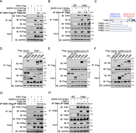 SARS-CoV-2 N protein inhibits the binding between TAK1 and TAB2, unlike SARS-CoV N protein. (A) HEK293T cells were transfected with Flag-TAK1, Flag-SARS-CoV-2 N, Flag-empty vector, HA-TAB2, and HA-empty vector. Lysates were collected for immunoprecipitation (IP) (anti-HA) and immunoblot (IB) analysis. The ratio of the gray value between IP TAK1-Flag and IP TAB2-HA was determined. (B) HEK293T cells were transfected with Myc-empty vector or Myc-SARS-CoV-2 N for 48 h, followed by TNF-α treatment for 4 h. Lysates were subjected to immunoprecipitation (anti-TAB2) and immunoblot analysis. The ratio of the gray value between IP TAK1 and IP TAB2 was determined. (C) Domain organization of TAB2 and its truncated mutants. CUE, Ubiquitin binding domain; TBD, TAK1 binding domain; NZF, NLP4-like zinc finger domain. (D–F) HEK293T cells were transfected Flag-empty vector, Flag-TAK1 (D), Flag-SARS-CoV-2 N (E), or Flag-SARS-CoV N (F) along with HA-TAB2 full-length (FL), HA-TAB2 (1–392aa), HA-TAB2 (1–496aa), HA-TAB2 (1–574aa), and HA-TAB2 (1–653aa). Lysates were subjected to immunoprecipitation (anti-Flag) and immunoblot analysis. (G) HEK293T cells were transfected with Flag-TAK1, Flag-empty vector, Myc-SARS-CoV N, Myc-empty vector, HA-TAB2, and HA-empty vector. Lysates were collected for immunoprecipitation (anti-HA) and immunoblot analysis. The ratio of the gray value between IP TAK1-Flag and IP TAB2-HA was determined. (H) HEK293T cells were transfected with Myc-empty vector or Myc-SARS-CoV N for 48 h, followed with TNF-α treatment for 4 h. Lysates were subjected to immunoprecipitation (anti-TAB2) and immunoblot analysis. The ratio of the gray value between IP TAK1 and IP TAB2 was determined. Data are done at least twice, and one representative is shown. Source data are available for this figure: SourceData F4. Refer to the image caption for details.