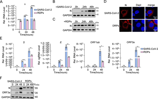 The RDP system simulates SARS-CoV-2 infection. (A–C) Caco-2 cells were infected with SARS-CoV-2 at an MOI of 0.01 and Caco-2-SARS-CoV-2 N cells were infected with RDPs at an MOI of 0.01 for 24 and 48 h. RNA extracted from the cells was evaluated by RT-qPCR (A) and lysates were subjected to immunoblot analysis (B and C). (D) Caco-2 cells were infected with SARS-CoV-2 at an MOI of 0.05 and Caco-2-SARS-CoV-2 N cells were infected with RDPs at an MOI of 0.05 for 48 h. Nucleus marker DAPI (blue) and SARS-CoV-2 N (red) were then visualized with confocal microscopy. Scale bars, 10 μm. (E and F) Caco-2 cells were infected with SARS-CoV-2 at an MOI of 0.01 and Caco-2-SARS-CoV-2 N cells were infected with RDPs at an MOI of 0.01 for 24 and 48 h. RNA extracted from the cells was evaluated by RT-qPCR (E), and lysates were subjected to immunoblot analysis (F). Graphs show mean ± SEM (n = 3 in A and E). *P < 0.05, **P < 0.01, ***P < 0.001, ****P < 0.0001, ns, not significant (unpaired, two-tailed Student’s t test). Data in B–D and F are expressed at least twice in independent experiments, and one representative is shown. Data in A and E are expressed in at least three independent experiments. Source data are available for this figure: SourceData FS2.