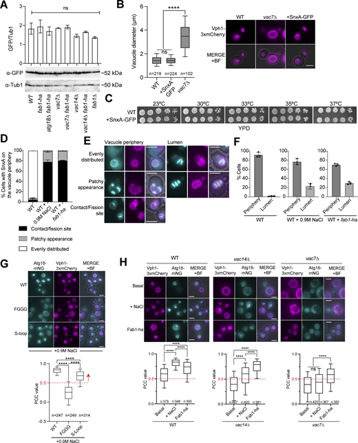 Properties of SnxA-GFP and Atg18-mNG as in vivo PI(3,5)P2sensors. (A) SnxA-GFP expression levels in different strains. A representative immunoblot is shown in the bottom. Tub1 was used as a loading control. The graph on the top of each band shows the average of anti-GFP to anti-Tub1 band intensity ratios from four experiments. Error bars: standard error of the mean. Strains used: MHY286, MHY288, MHY293, MHY304, MHY305, MHY303, MHY302, and AAY007. (B) Box-and-whisker graph and representative images of vacuole diameters in wildtype (WT), vac7∆, and SnxA-GFP containing yeast cells (BBY070, MHY286, and SEY256). Data shown come from three independent experiments. Boxes show 25th and 75th percentiles, whiskers indicate 10th and 90th percentiles, and the line in the boxes represents the median. Ordinary one-way ANOVA was performed with Fisher’s least significant difference (LSD) test. ****P < 0.0001, ns: non-significant with P = 0.7079. Scale bars: 3 μm. BF: bright field. (C) Spot assays that show growth of cells with (+SnxA-GFP) or without SnxA-GFP. Serial dilutions of indicated strains (ESM356-1 and MHY286) were spotted on YPD plates and incubated at indicated temperatures. (D–F) Vacuolar localization patterns of SnxA. SnxA-GFP is shown in cyan, Vph1-3xmCherry is shown in magenta. (G) Analysis Atg18-mNG colocalization with Vph1-3xmCherry upon hyperosmotic shock. Atg18, Atg8-Sloop mutant, and Atg18-FGGG mutant C-terminally fused with mNG were analyzed (MUK089, MUK090, and MUK091). Atg18-FGGG mutant served as a negative control for vacuole periphery localization. The PCC value of 0.5, indicated with a red dashed line, was selected as a threshold for vacuole membrane localization based on the PCC data of Atg18-FGGG. Data come from two independent experiments. (H) Atg18-mNG vacuole localization reflects PI(3,5)P2 levels. PI(3,5)P2 levels were manipulated through the use of mutants that are deficient in PI(3,5)P2 (vac7∆ and vac14∆), as well as through the use of fab1-ha and 0.9 M NaCl treatment in combination with wildtype and vac7∆ and vac14∆ mutants. PCC values of mNG and Vph1-3xmCherry colocalization were plotted, and representative images were also shown. Analyzed strains: MUK089, MUK098, MUK081, MUK113, MUK080, and MUK110. Data come from three independent experiments. In box-and-whiskers graphs, boxes show the 25th and 75th percentiles, whiskers point to the 10th and 90th percentile, and the line in the boxes represents the median. In G and H, ordinary one-way ANOVA was performed with Fisher’s LSD test. ****P < 0.0001, and ns: non-significant with P = 0.9908. Scale bars are 3 μm. Source data are available for this figure: SourceData FS1. Refer to the image caption for details.