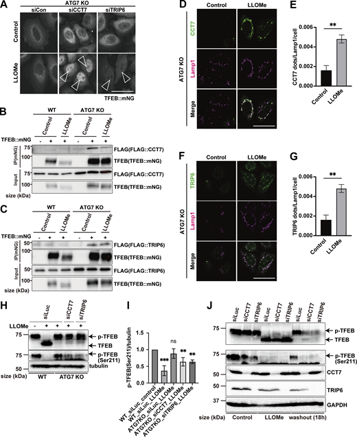 Identification of Mode II regulators of TFEB during lysosomal damage. (A) Representative fluorescence images of ATG7 KO cells stably expressing TFEB::mNG and transfected with scrambled siRNA (siCon), siCCT7, and siTRIP6. Cells were either untreated (control) or treated with 1 mM LLOMe for 3 h. Arrowheads indicate nuclear-localized TFEB::mNG. (B and C) Representative immunoblots of FLAG and TFEB in WT or ATG7 KO HeLa cells with or without stable TFEB::mNG expression. FLAG::CCT7 (B) or FLAG::TRIP6 (C) was transiently transfected and then treated or not treated (control) with 1 mM LLOMe for 3 h, followed by immunoprecipitation with an antibody against mNG. (D and F) Representative fluorescence images of HeLa cells stably expressing mNG::CCT7 (D) or mNG::TRIP6 (F) (green). Lysosomes were stained with an antibody against LAMP1 (magenta). Cells were either treated or not treated (control) with 1 mM LLOMe for 3 h. (E and G) Quantification of immunofluorescence data shown in D or G, respectively (n = 3 biologically independent samples). (H) Representative immunoblots of TFEB, p-TFEB (Ser211), and tubulin under control conditions and 1 mM LLOMe treatment for 3 h in WT and ATG7 KO HeLa cells. Cells were transfected with siLuc, siCCT7, and siTRIP6. (I) Quantification of image data of p-TFEB (Ser211)/tubulin shown in H (n = 3 biologically independent samples). (J) Representative immunoblots of TFEB, p-TFEB (Ser211), CCT7, TRIP6, and GAPDH in WT HeLa cells under control and 3 or 18 h after 1 mM LLOMe treatment conditions. Cells were transfected with siLuc, siCCT7, and siTRIP6. (A, D, and F) Scale bars, 50 µm. (E and G) P values were determined by a t test; **P < 0.01. (I) P values were determined by ANOVA with Tukey’s multiple comparison test; **P < 0.01, ***P < 0.005. Source data are available for this figure: SourceData F3.