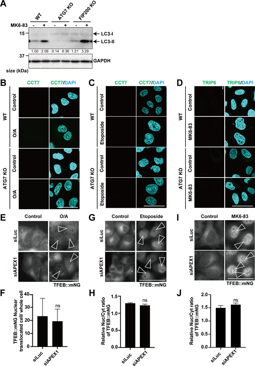 Differential requirements of APEX1 or TRIP6/CCT7 for TFEB activation under several cellular stressors. (A) Representative immunoblots of LC3 and GAPDH in WT, ATG7 KO, or FIP200 KO HeLa cells were either untreated (control) or treated with MK6-83 for 3 h. Values indicating the amount of LC3-II were normalized to the levels of the GAPDH in each. (B–D) Representative fluorescence images of WT or ATG7 KO HeLa cells transiently expressing mNG::TRIP6 or mNG::CCT7, either untreated (control) or treated with O/A or etoposide or MK6-83. (E) Representative fluorescence images of WT HeLa cells stably expressing TFEB::mNG, either untreated (control) or treated with O/A for 3 h. Cells were transfected with siLuc or siAPEX1. (F) Quantification of image data shown in E (n = 3 biologically independent samples). (G) Representative fluorescence images of WT HeLa cells stably expressing TFEB::mNG, either untreated (control) or treated with etoposide for 24 h. Cells were transfected with siLuc or siAPEX1. (H) Quantification of image data shown in G (n = 3 biologically independent samples). (I) Representative fluorescence images of WT HeLa cells stably expressing TFEB::mNG, either untreated (control) or treated with MK6-83 for 3 h. Cells were transfected with siLuc or siAPEX1. (J) Quantification of image data shown in I (n = 3 biologically independent samples). (B–D, E, G, and I) Scale bars, 50 µm. (E, G, and I) Arrowheads indicate nuclear-localized TFEB::mNG. (F, H, and J) Relative value of the TFEB nuclear translocation rate under drug treatment conditions compared with that under basal (control) conditions. A t test was used to compare the mean values of TFEB nuclear translocation rate in each condition. Source data are available for this figure: SourceData FS7. Refer to the image caption for details.