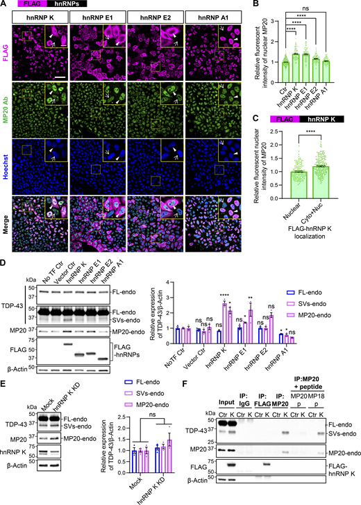 hnRNP K induces the protein expression of endogenous TDP-MP20. (A) Immunocytochemistry of HeLaS3 cells overexpressing FLAG-hnRNPs. MP20-endo (green), FLAG (magenta), and Hoechst (blue). Yellow boxes indicate magnified images (scale bar: 10 μm). Arrowheads and arrows denote FLAG-positive and FLAG-negative cells, respectively. Scale bar: 50 μm. (B) Quantification of nuclear MP20 fluorescence intensity in FLAG-hnRNPs–positive cells. A total of 100 FLAG-positive and 100 FLAG-negative cells per group were analyzed. Fluorescence signals were normalized to the average intensity of 400 FLAG-negative cells. Statistical analysis was performed using one-way ANOVA followed by Dunnett’s test. (C) Comparison of nuclear MP20 signals in cells with FLAG-hnRNP K localized in the nucleus only (Nuc) versus in both the cytoplasm and nucleus (Cyto+Nuc). Nuc: 123 cells; Cyto+Nuc: 177 cells. Welch’s t test was used for statistical analysis. (D and E) WB analysis of HEK293T cells overexpressing FLAG-hnRNPs (D) or with hnRNP K KD (E). Quantification of the relative expression of FL-endo, SVs-endo, and MP20-endo (n = 3 for each group). Data are normalized to β-actin. Statistical analyses were performed using one-way ANOVA followed by Dunnett’s test (D) or Welch’s t test (E). (F) IP of FLAG-hnRNP K overexpressed in HEK293T cells using MP20 or FLAG Ab, with or without peptide absorption by MP20- or MP18-immunizing peptides. An anti-IgG Ab was used as a negative control. All graphs show the mean ± SEM. *P < 0.05, **P < 0.01, and ****P < 0.0001. Ab, antibody. Source data are available for this figure: SourceData F5.