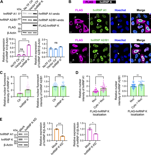 hnRNP K enhances hnRNP A1 expression. (A) WB analysis of HEK293T cells overexpressing FLAG-hnRNP K. Quantification of relative expression levels of hnRNP A1 and hnRNP A2/B1 is shown (n = 3 for each group). (B) Immunocytochemistry of HeLaS3 cells overexpressing FLAG-hnRNP K. FLAG (magenta), hnRNP A1 or hnRNP A2/B1 (green), and Hoechst (blue). Arrowheads indicate FLAG-positive cells, while arrows indicate FLAG-negative cells. Scale bar: 10 μm. (C) Quantification of nuclear hnRNP A1 or hnRNP A2/B1 fluorescence intensity in FLAG-hnRNP K–positive and –negative cells. A total of 100 FLAG-positive and 100 FLAG-negative cells per group were analyzed. Statistical analyses were performed using Welch’s t test. (D) Comparison of nuclear hnRNP A1 or hnRNP A2/B1 fluorescence intensity in cells with FLAG-hnRNP K localized only in the nucleus (Nuc) versus in both the cytoplasm and nucleus (Cyto+Nuc). For hnRNP A1, Nuc: 52 cells, Cyto+Nuc: 48 cells; for hnRNP A2/B1, Nuc: 64 cells, Cyto+Nuc: 35 cells. Statistical analyses were performed using Welch’s t test. (E) WB analysis of HEK293T cells with hnRNP K KD. Quantification of relative expression levels of hnRNP K or hnRNP A1 is shown (n = 3 for each group). In A and E, data are normalized to β-actin. Statistical analyses were performed using one-way ANOVA followed by Dunnett’s test (A) or Welch’s t test (E). All graphs show the mean ± SEM. *P < 0.05, **P < 0.01, ***P < 0.001, and ****P < 0.0001. Source data are available for this figure: SourceData F6.