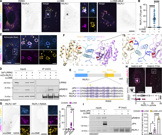 LRRK2 recruits RILPL1 to damaged lysosomes via pRAB proteins. (A) U2OS cells were transfected with HaloTag-LRRK2 for 36 h. Cells were then treated with DMSO, LLOME, or LLOME+MLi2 for 2 h before fixation. Cells were then stained for RILPL1 and LAMP2. (B) Quantification of the RILPL1 lysosomes per cell in the three different conditions. Data are mean ± SEM (P < 0.0001, n = 21 cells). One-way ANOVA with Tukey’s post hoc tests. (C) Mouse primary astrocytes were transfected with HaloTag-LRRK2, mCherry-RILPL1, and LAMP1-mNeonGreen for 48 h. Astrocytes were treated with LLOME for 6 h and imaged live. (D) HEK293FT cells were transfected with 3xflag-LRRK2 and mCherry-RILPL1 for 24 h. Cells were treated or not with LLOME for 2 h, and lysates were subjected to immunoprecipitation with anti-RFP antibodies. RFP, LRRK2, and pT73-RAB10 were blotted. (E) RILP-RHD2 alignment of JIP3, JIP4, RILPL1, and RILPL2 using Clustal (Clustal Omega, EMBL). Arrowheads show the conserved Arg. residues responsible for the binding with the pRAB substrates. Filled arrowhead marks the Arg. that binds with the phosphorylated residue, and the empty arrowhead indicates the Arg. that stabilizes the interaction. (F) Structural model of the interaction between the RHD2 of RILPL1 and RAB10, showing the interaction between T73-RAB10 and R293-RILPL1. (G) U2OS cells were transfected with HaloTag-LRRK2 and mCherry-RILPL1 (WT or R293A) for 36 h. Cells were then treated with DMSO or LLOME for 2 h, fixed, and stained for LAMP1. Quantification of RILPL1-positive lysosomes per cell in the different groups. Data are mean ± SEM (P = 0.0009 and P = 0.001, n = 16 cells). Brown–Forsythe and Welch ANOVA with Dunnett’s post hoc test. (H) U2OS cells were transfected with 3xflag-LRRK2, along with 2xmyc-RAB10 (WT) or 2xmyc-RAB10 (T73A). Cells were then treated with LLOME for 2 h, fixed, and stained with anti-flag, anti-myc, and anti-RILPL1 antibodies. Graph shows the quantification of RILPL1 puncta per cell in the different conditions. Data are mean ± SEM (P= 0.0006, n = 28–32 cells). Unpaired t test. (I) HEK239T cells were transfected with HaloTag-LRRK2 and 2xmyc-RILPL1, and one group was also transfected with Ubc-3xHA-JIP4 for 24 h. Cells were then treated or not with LLOME (2 h) and subjected to anti-myc immunoprecipitation. Graph shows the amount of RILPL1:T73-RAB10 interaction in the different groups. Data are mean ± SEM (P < 0.0001, P= 0.0293; N = 5 independent replicates). One-way ANOVA with Tukey’s post hoc test. Scale bar (A, G, and H) = 10 µm; (C) = 20 µm. Insets (A and H) = 2 µm; (C) = 4 µm. Source data are available for this figure: SourceData F3.