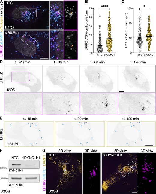 RILPL1 promotes LRRK2+lysosome clustering around the centrosome. (A) U2OS cells were treated with a nontargeting control (NTC) or siRILPL1 RNA. 24 h later, cells were transfected with HaloTag-LRRK2 for 36 h. Then, cells were treated with LLOME (2 h) and were fixed and stained with a pericentrin antibody. Volume view image of LRRK2+ lysosomes clustered around the centrosome (pericentrin). (B) The distance between LRRK2+ lysosomes and the centrosome was measured in cells treated with NTC or siRILPL1. Data are mean ± SEM (P < 0.0001, n = 221–222 lysosomes, from 7 to 9 cells). Unpaired t test with Welch’s correction. (C) The distance between LRRK2+ lysosomes and the center of the nucleus was measured in cells treated with NTC or siRILPL1. Data are mean ± SEM (P = 0.0206, n = 221–222 lysosomes, from 7 to 9 cells). Unpaired t test. (D and E) Time-lapse of a U2OS cell expressing HaloTag-LRRK2 and treated with LLOME. LRRK2 puncta recruitment and movement are followed at different time points up to 120 min. (D) is a control cell, and (E) is a cell previously transfected with a RILPL1 siRNA. (F) U2OS cells treated with a NTC and siRNA against DYNC1H1 were lysed and blotted against anti-DYNC1H1 and a-tubulin antibodies. (G) U2OS cells were incubated with NTC or siDYNC1H1 (24 h) and transfected with HaloTag-LRRK2, mBaoJin-RILPL1, and LAMP1-RFP (36 h). Cells were then imaged live after treatment with LLOME (2 h). Arrowheads indicate LRRK2+ lysosomes. Scale bar = 10 µm. Insets = 2 µm. Source data are available for this figure: SourceData F4.