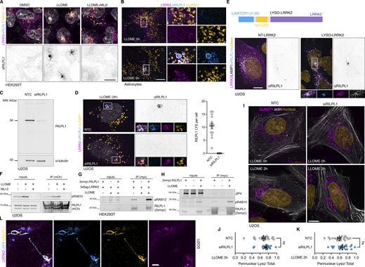 Additional information regarding RILPL1 recruitment to lysosomes by LRRK2. (A) HEK293T cells stably expressing GFP-LRRK2 and TMEM192-3xHA were seeded for 24 h and treated with DMSO, LLOME (2 h), and LLOME+MLi2. Cells were then fixed and stained for HA and endogenous RILPL1. (B) Mouse primary astrocytes were transfected with 3xflag-LRRK2 for 48 h. Cells were then treated or not with LLOME for 6 h, fixed, and stained for endogenous LAMP1 and RILPL1. (C) U2OS cells were treated with a nontargeting control (NTC) or siRILPL1 for 60 h. Cells were then lysed and blotted for endogenous RILPL1. (D) U2OS cells were treated with a NTC or siRILPL1 for 24 h. Cells were then transfected with 3xflag-LRRK2 for 36 h, treated with LLOME for 2 h, and fixed. Cells were stained for endogenous RILPL1 and LAMP1. Graph shows the number of RILPL1-positive lysosomes per cell in both conditions (n = 13–14 cells). (E) U2OS cells were transfected with LAMP1-HaloTag and 3xflag-LRRK2 (NT-LRRK2) or LAMTOR1(1–39)-3xflag-LRRK2 (LYSO-LRRK2) for 36 h. Cells were fixed and stained for endogenous RILPL1. (F) U2OS cells were transfected with HaloTag-LRRK2 and mCherry-RILPL1 for 36 h. Cells were then treated or not with LLOME (2 h) or pre-treated with MLi2. Lysates were subjected to immunoprecipitation with anti-RFP antibodies. (G) HEK293T cells were transfected with 3xflag-LRRK2 and 2xmyc-RILPL1 for 24 h. Then cells were treated or not with LLOME for 2 h. Lysates were subjected to immunoprecipitation with anti-myc antibodies and blotted against pS106-RAB12 and myc antibodies. (H) HEK293T cells were transfected with 3xflag-LRRK2 and 2xmyc-RILPL1 for 24 h. Then cells were treated or not with LLOME for 2 h. Lysates were subjected to immunoprecipitation with anti-myc antibodies and blotted against JIP4, pT73-RAB10, and myc antibodies. (I) U2OS cells were treated with a NTC or siRILPL1 for 24 h. Cells were then transfected with LifeAct-mNeonGreen for 36 h, treated or not with LLOME for 2 h, and fixed. Cells were then stained for endogenous LAMP1. (J and K) Graphs show the perinuclear ratio of lysosomes in the different conditions. Unpaired t test. Data are mean ± SEM (n = 20 cells). (L) U2OS cells transfected with HaloTag-LRRK2 and mNeonGreen-JIP4 for 36 h and treated with LLOME for 2 h before fixing. Cells were then stained for endogenous RILPL1. Scale bar = 10 µm. Source data are available for this figure: SourceData FS3.