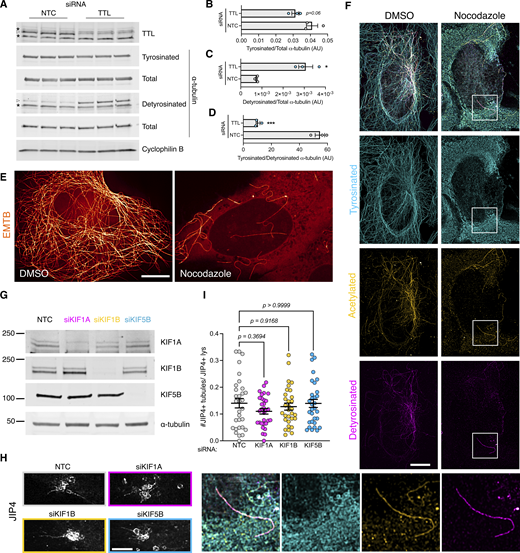 Additional information regarding tyrosinated α-tubulin and LYTL tubule elongation. (A) U2OS cells were transfected with a nontargeting control (NTC) or TTL siRNA for 60 h. WB shows tyrosinated α-tubulin, detyrosinated α-tubulin, total α-tubulin, and cyclophilin B protein levels. (B) Histogram showing tyrosinated α-tubulin protein levels normalized to total α-tubulin. Unpaired t test was used (P = 0.066, n = 3). (C) Histogram showing detyrosinated α-tubulin protein levels normalized to total α-tubulin. Unpaired t test with Welch’s correction was used (P = 0.0185, n = 3). (D) Histogram showing the normalized tyrosinated/detyrosinated α-tubulin ratio. Unpaired t test was applied (P = 0.0003, n = 3). Asterisks signal unspecific bands; real bands are shown in arrowheads. (E) U2OS cells were transfected with EMTB-mNeonGreen and treated with DMSO or nocodazole (10 µM, 30 min) and imaged live under a confocal microscope. (E) U2OS cells were treated with DMSO or nocodazole (10 µM, 30 min) and fixed. (F) U2OS cells treated with DMSO or nocodazole were fixed and stained for tyrosinated α-tubulin, detyrosinated α-tubulin, and acetylated α-tubulin. (G and H) U2OS cells were transfected with a NTC or KIF1A, KIF1B, and KIF5B siRNA for 24 h. Cells were then transfected with HaloTag-LRRK2 and mNeonGreen-JIP4 for 36 h and treated with LLOME for 2 h. Cells were then fixed and stained for endogenous LAMP2. (I) Graph depicts the #JIP4+ tubules/JIP4+ lysosomes ratio in all conditions. Brown–Forsythe and Welch ANOVA with Dunnett’s. Data are mean ± SEM (n = 31 cells). Scale bar = 10 µm. Source data are available for this figure: SourceData FS5.