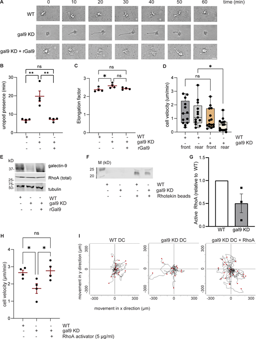 Galectin-9 regulates uropod contractility. (A) Time-lapse sequence of representative WT, gal9 KD, and gal9 KD+rGal9 moDCs migrating in a 3D collagen gel. Scale bar = 50 µm. Scale bar = 10 µm. (B and C) Mean ± SEM duration (min) of uropod presence (B) and cell elongation factor (C) in WT, gal9 KD, and gal9 KD + rGal9 moDCs for four independent donors (black dots). At least 20 cells were analyzed for each donor and condition. (D) Velocity of the front or rear in WT and gal9 KD moDCs. Graphs depict the mean ± SEM for four independent donors (individual cells represented by black symbols). (E) Total lysates from WT, gal9 KD, and gal9 KD +rGal9 moDCs were subjected to western blot and galectin-9 and total RhoA expression analyzed. Tubulin was used as a loading control. Immunoblot is representative of four independent donors. (F) Levels of active (GTP-bound) RhoA in WT and gal9 KD moDCs detected by immunoblotting. Rhotekin beads alone were used as a negative control (lanes 2 and 3). (G) Quantification of data shown in F. The graph depicts relative active RhoA content in galectin-9–depleted DCs (gal9 KD) compared with relevant WT control for three independent experiments. (H) WT or gal9 KD moDCs were embedded in 3D collagen matrices prior to being treated with a RhoA activator or PBS as a negative control. The graph depicts mean cell velocity ± SEM for four independent donors (black symbols). At least 20 cells were analyzed for each donor and condition. (I) Individual trajectory plots of WT and gal9 KD DCs untreated or treated with the RhoA activator of one representative donor out of four analyzed. End track points are indicated by red dots. The black line indicates the overall movement in x and y direction (µm). One-way ANOVA test with a Bonferroni posttest correction was conducted to test significance. n.s., P > 0.05; *P < 0.05; **P < 0.01. Source data are available for this figure: SourceData F5. Refer to the image caption for details.
