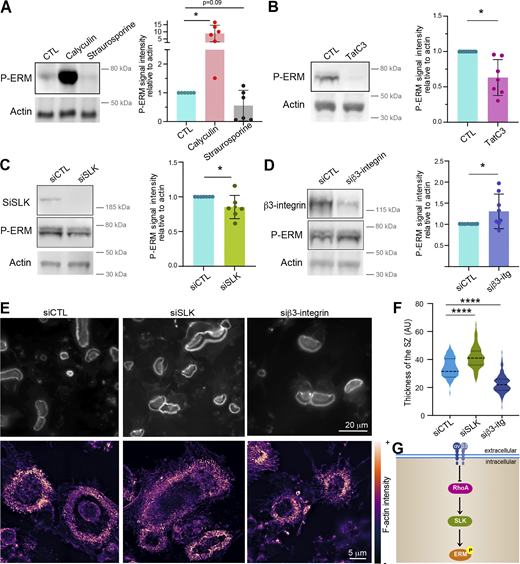 The Rho/SLK axis downstream of β3-integrin controls ERM activation and sealing zone formation. (A) Effect of calyculin and staurosporine treatment on ERM activation (P-ERM), used as positive and negative control for western blot analysis of ERM activation, respectively. 6-day hOCs were treated or not (CTL) with calyculin and staurosporine. Representative western blot analysis (left) and quantification of P-ERM signal normalized to actin (right). Each circle represents a single donor, n = 6, SDs are shown. (B) RhoA inhibition reduces ERM activation. 6-day hOCs were treated or not (CTL) with TATC3, targeting the RhoGTPases RhoA. Representative western blot analysis (left) and quantification of P-ERM signal normalized to actin (right). Each circle represents a single donor, n = 6, means ± SDs are shown. (C) SLK suppression reduces ERM activation. hOCs were treated with non-targeting siRNA (siCTL) or siRNA targeting SLK kinase (siSLK). Representative western blot analysis (left) and quantification of P-ERM signal normalized to actin (right). Each circle represents a single donor, n = 7, means ± SDs are shown. (D) β3-integrin suppression favors ERM activation. hOCs were treated with nontargeting siRNA (siCTL) or siRNA targeting β3-integrin (si β3-integrin). Representative western blot analysis (left) and quantification of P-ERM signal normalized to actin (right). Each circle represents a single donor, n = 7, SDs are shown. Predicted molecular weights are indicated (A–D). (E and F) Effect of SLK and β3-integrin depletion on the formation of sealing zones in hOCs. (E) Representative microscopy images of sealing zones visualized by F-actin staining (phalloidin: white in upper panels and colored-coded intensity in lower panels). Scale bars, 20 and 5 µm. (F) Quantification of sealing zone thickness (n = 2 donors, 15–20 cells/condition and 3 locations/SZ). (G) Schematics showing the proposed Rho/SLK axis downstream of β3-integrin for ERM activation. Statistical analyses: Multiple comparison tests (A) Friedman and then Dunn’s, and (F) Kruskal–Wallis and then Dunn’s. ****P ≤ 0.0001. Source data are available for this figure: SourceData F6.