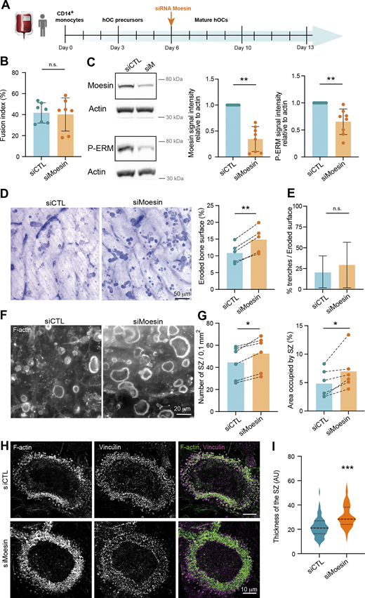 Moesin role in bone degradation is independent of its role in osteoclast fusion. (A) Experimental design of moesin depletion in late stages of hOC differentiation. (B) Effect of moesin depletion (siMoesin) on hOC fusion: quantification of fusion index after microscopy analysis of 10 day-differentiated hOCs on glass coverslips treated on day 6 with siCTL or siMoesin. Each circle represents a single donor, n = 7, SDs are shown. (C) Western blot analysis of moesin and P-ERM expression levels after moesin depletion in late stages of hOC differentiation. Representative western blot analysis (left) and quantification of moesin and P-ERM signals (right), normalized to actin. Predicted molecular weight are indicated. Each circle represents a single donor, n = 8, SDs are shown. (D–I) Effect of moesin depletion (siMoesin) in mature hOCs on bone degradation (D), morphology of the resorbed area (E), and sealing zone (SZ) formation (F–I). 10 day-differentiated hOCs on glass coverslips treated on day 6 with siCTL or siMoesin were detached and seeded for additional 24 h on bone slices. (D) Representative images of bone degradation (left, scale bar, 50 µm) and quantification of bone eroded surface (%) using semi-automatic quantification (right). Each circle represents a single donor, n = 5. (E) Quantification of the percentage of trenches (n = 2 independent experiments, SDs are shown). (F and G) (F) Representative microscopy images of sealing zone visualized by F-actin staining (phalloidin, white, scale bars, 20 µm); and (G) quantification of the number of sealing zones (number of SZ per bone surface (left) and the percentage of area covered by SZ (right). Each circle represents a single donor, n = 6. (H and I) Effect of moesin depletion (siMoesin) in mature hOCs on SZ organization (H) thickness (I). (H) Representative microscopy images of sealing zones visualized by F-actin and vinculin staining (phalloidin in pink and vinculin in green). Scale bars, 10 µm. (I) Quantification of sealing zone thickness (n = 3 donors, 15 SZ/condition, 2 locations/SZ). n.s., not significant. Source data are available for this figure: SourceData F5.