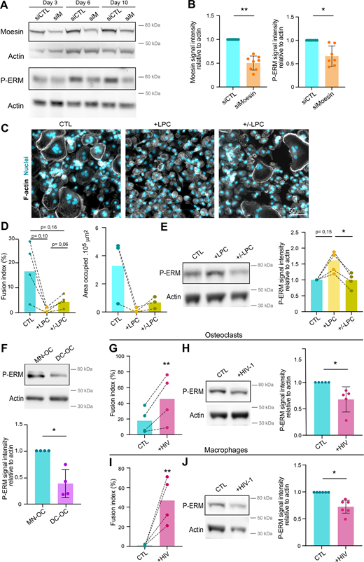 (Related toFig. 2). (A and B) Depletion of meosin by siRNA in hOC. Western blot analysis of moesin and activated ERM (P-ERM) expression level in hOC after treatment on day 0 with nontargeting siRNA (siCTL) or siRNA targeting moesin (siM), on days 3, 6, and 10 of differentiation. (A) Representative experiment and (B) quantification of moesin (left) and P-ERM (right) expression level normalized to actin. Each circle represents a single donor, n = 7–8, SDs are shown. (C–E) Effect of LPC treatment on hOC fusion and activated ERM expression level (P-ERM). On day 6 of differentiation, hOC were treated with LPC (+LPC, 17 h), or treated and then washed (90 min) (+/− LPC) or no treated (control, CTL). (C and D) Microscopy analysis of hOC fusion. (C) Representative microscopy images: F-actin (phalloidin, white) and nuclei (DAPI, cyan). Scale bar, 50 µm. (D) Quantification of fusion index (left) and area occupied by multinucleated OC (right). Each circle represents a single donor, n =3–4. (E) Western blot analysis of P-ERM expression level in each condition, normalized to actin. Representative blot (left panel) and quantification (right panel). Each circle represents a single donor, n = 4. (F) P-ERM signal by western blot analysis in murine inflammatory osteoclasts (DC-OC) versus control osteoclasts (MN-OC). See material and methods. Representative blot of P-ERM expression level in each condition (upper panel) and quantification of P-ERM expression level, normalized to actin (lower panel). Each circle represents a single mouse, n = 4, SDs are shown. (G–J) Effect of HIV infection on activated ERM expression level (P-ERM) in hOC (G and H) and macrophages (I and J). (G and H) On day 6 of differentiation, hOC were infected with the viral strain NLAD8-VSVG (+HIV-1) or not (CTL) and analyzed 8 days after infection. (G) Quantification of the fusion index (each circle represents a single donor, n = 4) and (H) representative western blot analysis of P-ERM expression level (left), and quantification of P-ERM expression level, normalized to actin (right, each circle represents a single donor, n = 5, SD is shown). (I and J) On day 6 of differentiation, macrophages were infected with the viral strain NLAD8-VSVG (+HIV-1) or not (CTL) and analyzed 7 days after infection. (I) Quantification of the fusion index (each circle represents a single donor, n = 4) and (J) representative western blot analysis of P-ERM expression level (left) and quantification of P-ERM expression level, normalized to actin (right). Each circle represents a single donor, n = 6, SDs are shown. Predicted molecular weights are indicated on western blots. Statistical analyses: (D and E) one-way ANOVA and then Tukey multiple comparison tests. P value is indicated on the graphs, *P ≤ 0.05. Source data are available for this figure: SourceData FS2.