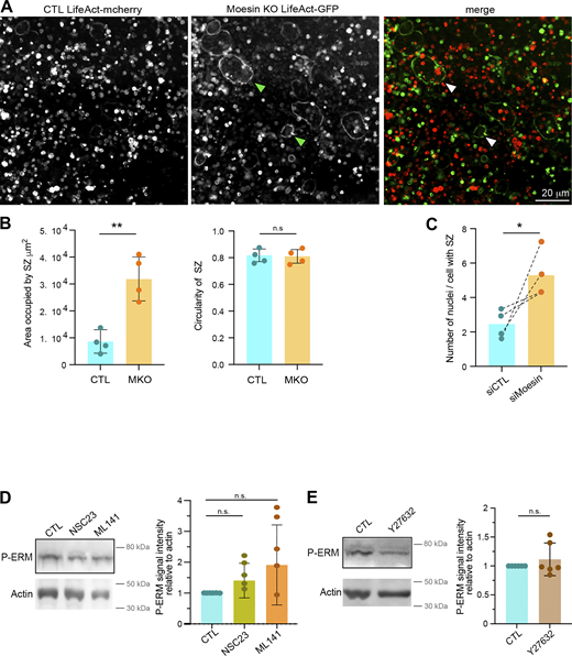 (Related toFigs. 4 and 6). (A) Representative image from a culture with 1:1 ratio of mOC control (CTL, transduced with mCherry-lifeact) and moesin KO (transduced with GFP-lifeact) seeded on glass coverslips on day 4 of differentiation. Arrowheads show green podosome belts. Scale bar, 20 µm. (B) Effect of moesin KO on sealing zone formation in mOC. mOC control (CTL) versus moesin KO (MKO) were cultured for 5 days on glass coverslips, detached and then seeded for additional 2 days on bone slices. Quantification of the area occupied by sealing zones (left) and circularity of sealing zones (right). Each circle represents a single donor, n = 4, SDs are shown. (C) Effect of moesin depletion on sealing zone formation in hOC. 6 day–differentiated hOC on glass coverslips treated on day 0 with siCTL or siMoesin were detached and seeded for additional 24 h on bone slices. Quantification of the number of nuclei per cells forming sealing zones. Each circle represents an independent experiment, n = 4 donors. n.s., not significant. (A–C related to Fig. 4). (D) Effect of NSC23 and ML-141 on ERM activation. 6-day hOCs were treated or not (CTL) with NSC23 and ML 141, drugs targeting Rac1/2 and Cdc42 respectively. Representative western blot analysis (left) and quantification of P-ERM signal normalized to actin (right). Each circle represents a single donor (n = 5, SDs are shown). (E) Effect of Y27632 (ROCK kinase inhibitor) treatment on P-ERM signal. Representative western blot analysis (left) and quantification of P-ERM signal normalized to actin (right). Each circle represents a single donor, n = 6, SDs are shown. Predicted molecular weight are indicated on western blots. (D and E related to Fig. 6) Statistical analyses: (D and E) Friedman and Dunn’s multiple comparison tests. n.s. not significant. Source data are available for this figure: SourceData FS5. Refer to the image caption for details.