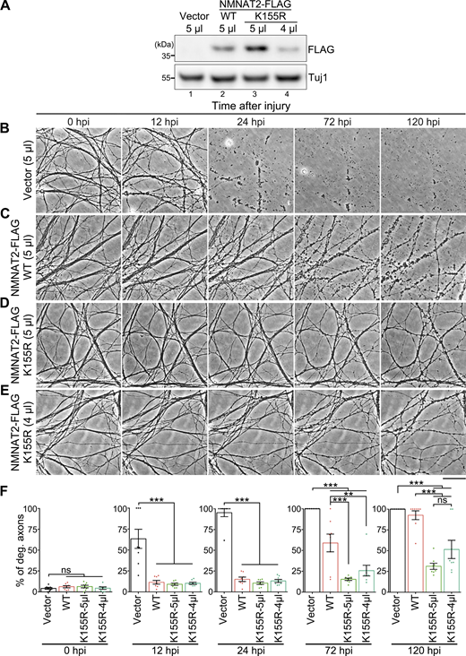 K155R mutation bestows more potent axon protection to NMNAT2. (A) Western blot analysis confirming the expression of WT and K155R of NMNAT2-FLAG in DRG neurons in B–E. Vector, hSyn-FLAG. (B–F) Representative phase contrast images (B–E) and quantifications (F) of axon degeneration of cultured mouse DRG neurons. Images are captured live at indicated time points after axotomy. The concentration of the NMNAT2-FLAG lentivirus is ∼1.13 × 106 viral particles/μl. % of deg. axons, percentage of degenerated axons. Mean ± SEM. n = 8 DRG cultures per group from pooled results of three independent repeats. One-way ANOVA. **P < 0.01 and ***P < 0.001; ns, not significant. Scale bar: 50 µm. Source data are available for this figure: SourceData F8.